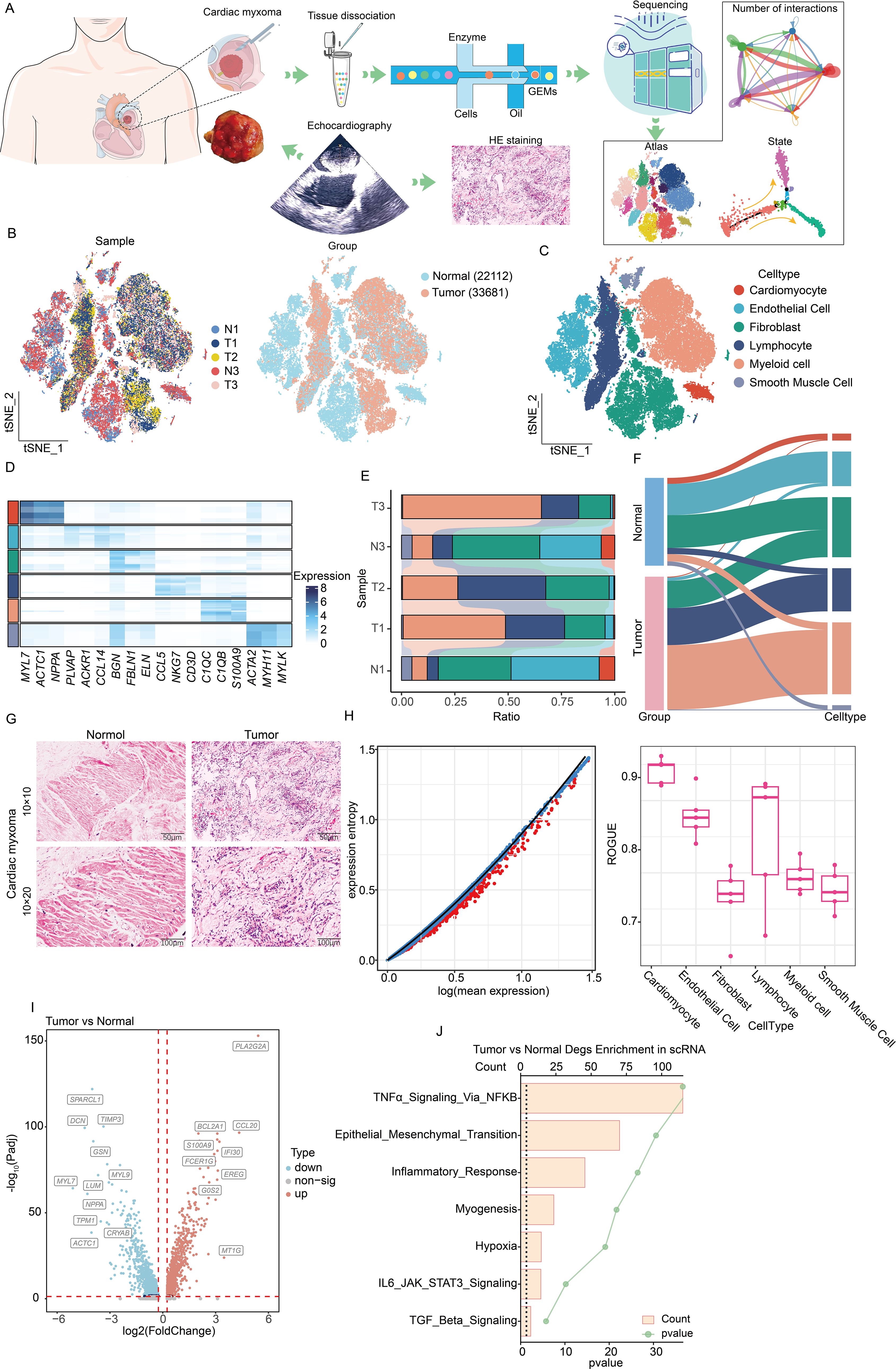 Multifaceted illustration of cardiac myxoma analysis. (A) Workflow illustrating tissue processing and analysis steps, including echocardiography and sequencing. (B, C) t-SNE plots depicting cell clustering by sample and cell type. (D) Heatmap showing gene expression levels across samples. (E) Bar graph detailing cell type ratios within samples. (F) Alluvial diagram linking group to cell type. (G) Histological images comparing normal and tumor tissues. (H) Graphs displaying expression entropy and ROUGE boxplots for cell type classification. (I) Volcano plot of gene expression changes between tumor and normal tissues. (J) Bar graph of pathway analysis highlighting significant biological processes.