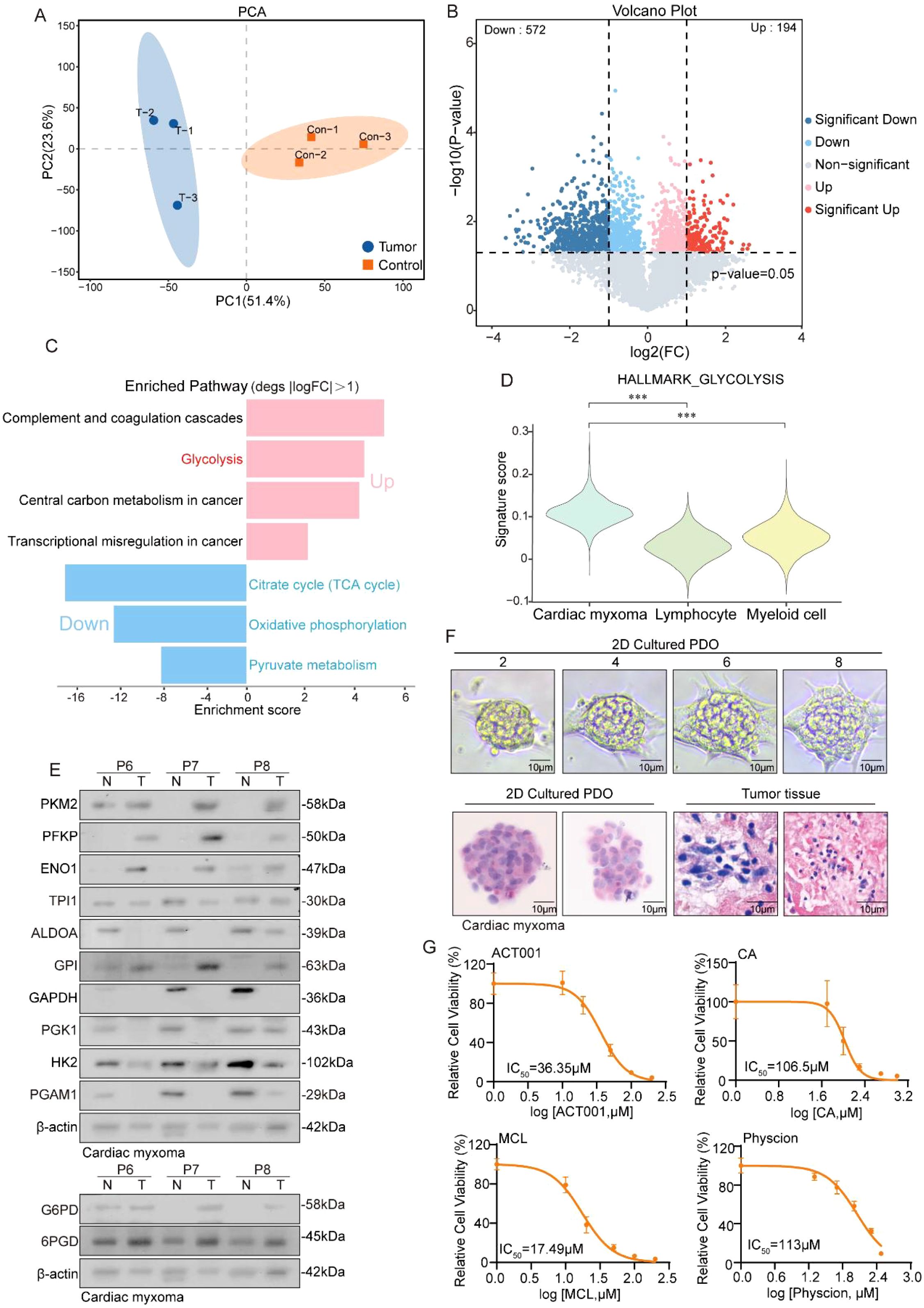 Panel A shows a PCA plot with two distinct clusters: tumor samples in blue and control samples in orange. Panel B is a volcano plot displaying gene expression changes, highlighting significantly upregulated (red) and downregulated (blue) genes. Panel C illustrates enriched pathways, with pathways like glycolysis marked as upregulated and others like the citric acid cycle as downregulated. Panel D features a violin plot comparing glycolysis signature scores across different cell types. Panel E displays Western blot results for various proteins in tumor versus normal samples. Panel F shows images of 2D cultured PDOs and tumor tissue at 10 micrometer scale. Panel G presents dose-response curves for four different compounds, indicating their effect on cell viability with IC50 values.