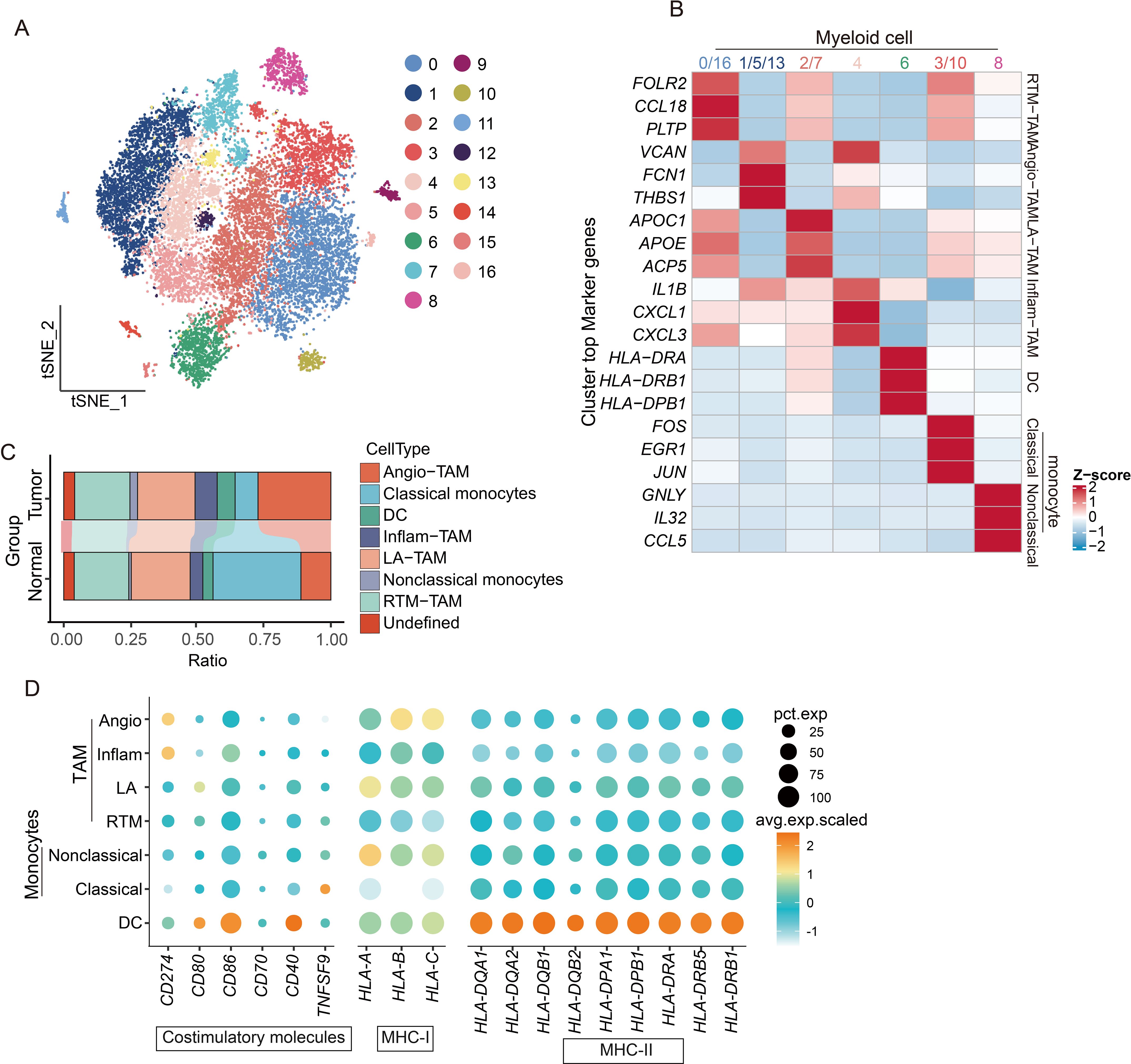 A composite image with five panels: (A) A t-SNE plot showing clusters of cells in different colors labeled from 1 to 16. (B) A stacked bar graph comparing cell type ratios between normal and tumor groups. (C) Four pie charts labeled T1, T2, T3, N2, and N3 showing proportions of different cell types. (D) A heatmap displaying the expression of marker genes in myeloid cells, with a color gradient indicating z-scores. (E) A dot plot illustrating expression levels of costimulatory molecules and MHC-I/II in various monocyte and TAM types, with dot size representing expression percentage.