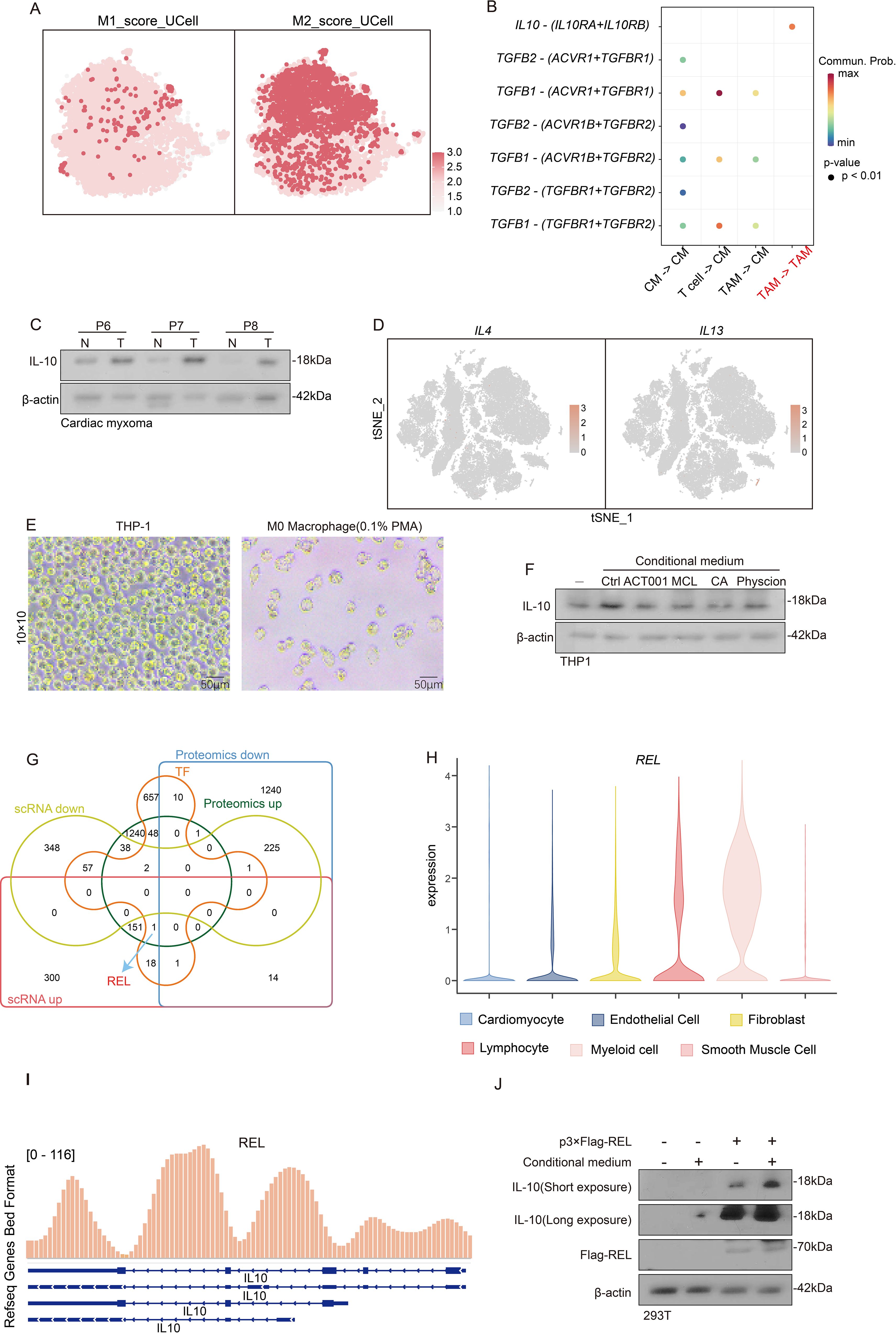 A multi-panel scientific figure displaying various analyses related to cardiac myxoma. Panel A shows two UCell score plots comparing M1 and M2 scores. Panel B illustrates network diagrams depicting interactions between T-cells, TAM, and cardiac myxoma, highlighting interaction weights and strengths. Panel C features a scatter plot of communication probabilities for different gene interactions. Panel D presents Western blots for IL-10 and β-actin in cardiac myxoma and normal samples. Panel E displays tSNE plots for IL4 and IL13 gene expression. Panel F shows microscopic images of THP-1 and M0 Macrophages. Panel G includes a Western blot for IL-10 in THP1 under different conditions. Panel H is a Venn diagram comparing scRNA and proteomics data. Panel I shows a violin plot for REL gene expression across various cell types. Panel J is a tSNE plot for REL expression. Panel K presents REL gene expression in a bed format graph. Panel L contains Western blots testing IL-10 and Flag-REL expression in 293T cells.