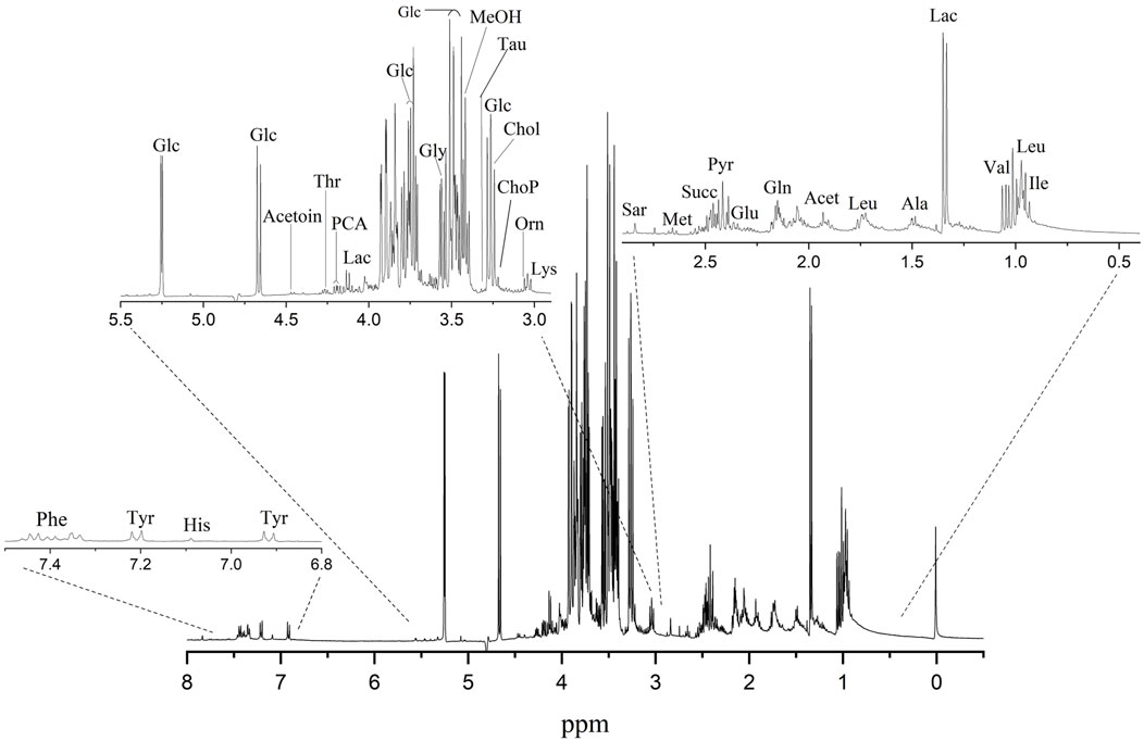 Nuclear Magnetic Resonance (NMR) spectrum showing various chemical compounds with labeled peaks, including glucose (Glc), lactate (Lac), methanol (MeOH), and others, annotated across a range of chemical shifts, measured in parts per million (ppm). There are three zoomed regions highlighting specific spectral details.