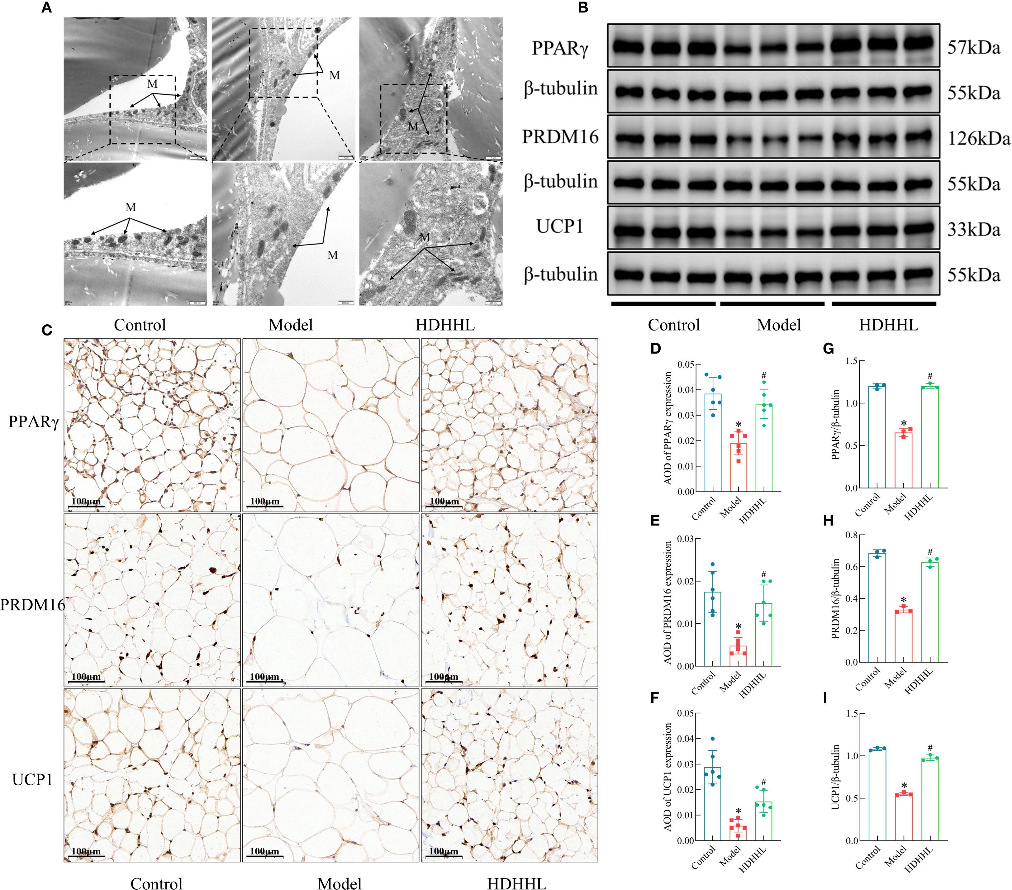 Section A shows electron microscopy images of mitochondria in different tissues with marked areas. Section B presents Western blot analyses for proteins PPARγ, PRDM16, and UCP1, with β-tubulin as a control. Section C features histological staining of tissues for PPARγ, PRDM16, and UCP1 across control, model, and treatment groups. Sections D to I include bar graphs depicting expression levels of the proteins, showing significant differences between groups.