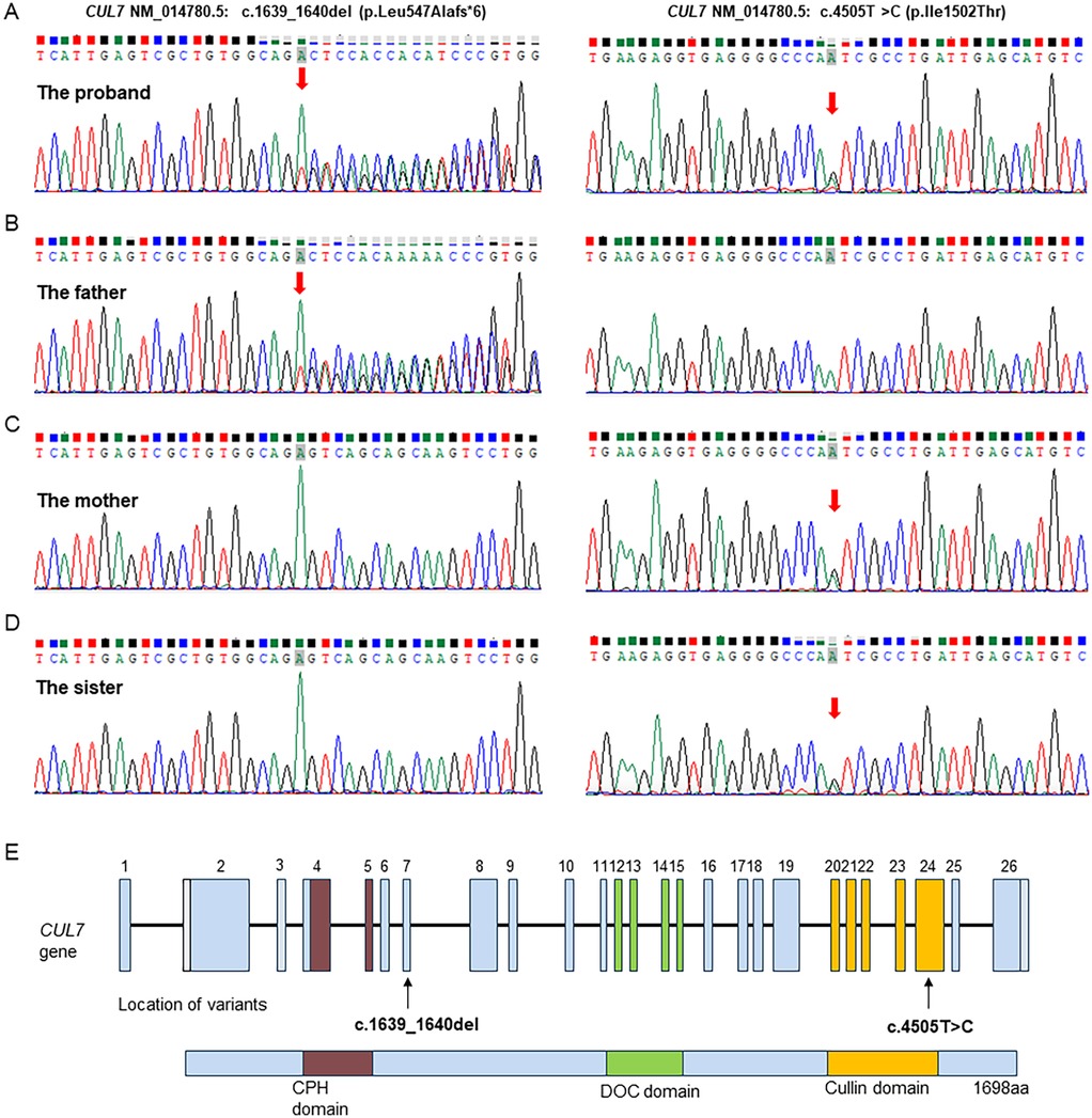 Genetic sequencing results display chromatograms for the proband, father, mother, and sister, highlighting variants in the CUL7 gene. Red arrows indicate mutations: c.1639_1640del (p.Leu547Alafs*6) and c.4505T>C (p.Ile1502Thr). A diagram at the bottom outlines the CUL7 gene structure with marked variant locations within specific domains, including CPH, DOC, and Cullin domains.