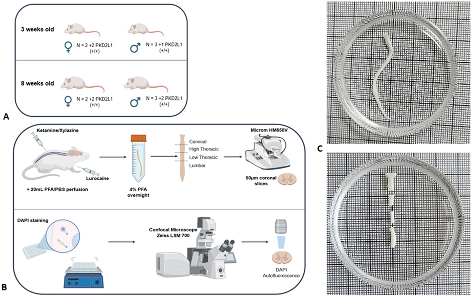 Diagram showing three panels labeled A, B, and C. Panel A depicts a study with mice at three and eight weeks old, indicating both sexes and PKD2L1 expression. Panel B illustrates a process involving a mouse injected with ketamine/xylazine, perfusion with PFA/PBS, spinal cord extraction, slicing, DAPI staining, and observation using a confocal microscope. Panel C features two circular grids with a serpentine structure and a segmented line resembling spinal cord slices.