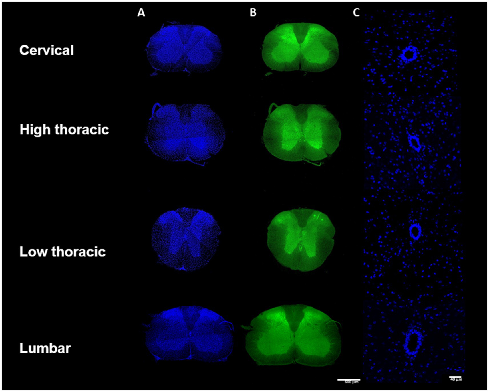 Fluorescent microscopy images of various spinal cord sections in three columns: Column A displays sections stained in blue, Column B in green, and Column C shows detailed cellular structures in blue. Rows represent cervical, high thoracic, low thoracic, and lumbar regions. Scale bars indicate 600 micrometers for sections and 20 micrometers for detailed images.