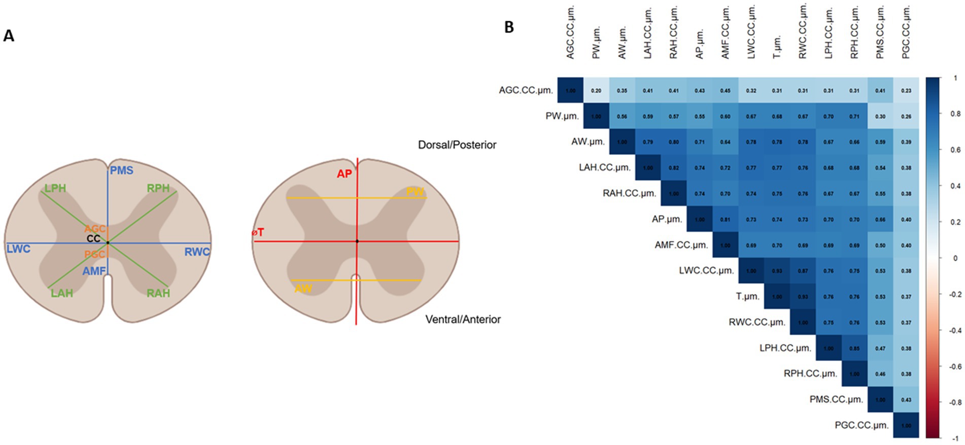Diagram of mouse spinal cord cross-sections and correlation matrix. Part A shows two drawings of the spinal cord with labeled regions, indicating anatomical axes and measurement points. Part B is a heatmap displaying correlation coefficients between these measurements, with varying shades indicating the strength of the correlations, from blue for strong positive to red for negative.