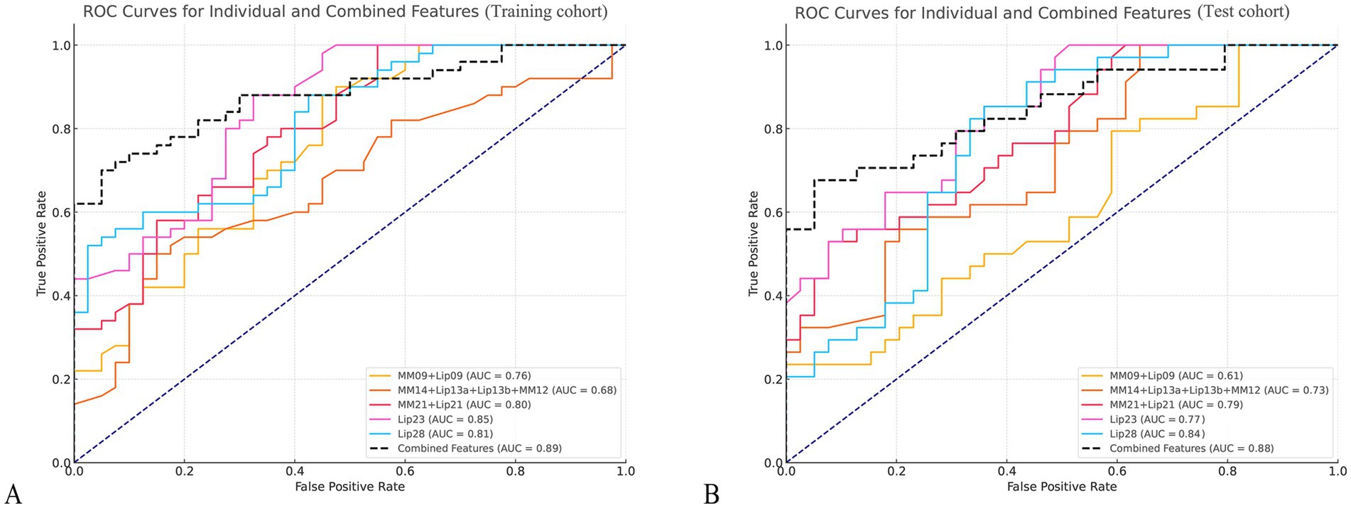 ROC curves for individual and combined features, comparing training and test cohorts. The left plot (A) shows the training cohort with various features achieving AUCs from 0.68 to 0.89. The right plot (B) shows the test cohort with AUCs from 0.61 to 0.88. The combined features give the highest AUC in both cohorts, shown with a black dashed line.