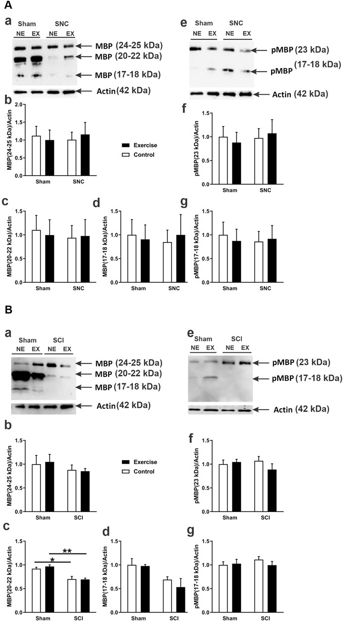 Western blot analysis of MBP and pMBP proteins with Actin as a loading control, comparing Sham and SNC/SCI conditions under Non-Exercise (NE) and Exercise (EX) states. Graphs present relative protein levels; bars distinguish Exercise from Control groups. Sub-panel A shows MBP at 24-25 kDa, 20-22 kDa, and 17-18 kDa, and Sub-panel B shows similar bands for SCI with additional markers. pMBP is analyzed at 23 kDa and 17-18 kDa. Quantification graphs (b-g) depict comparative ratios against Actin, with noted significance.
