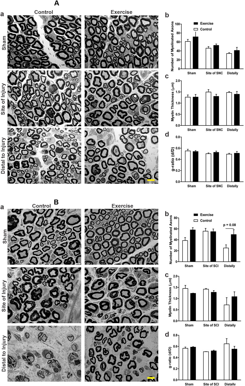 Electron micrographs and bar graphs depict nerve samples and measurements of myelinated axons. Panels A and B show control and exercise conditions at various nerve sites: sham, site of injury, and distal to injury. Bar graphs compare the number of myelinated axons, myelin thickness, and g-ratio between conditions, highlighting changes in exercise and control groups.