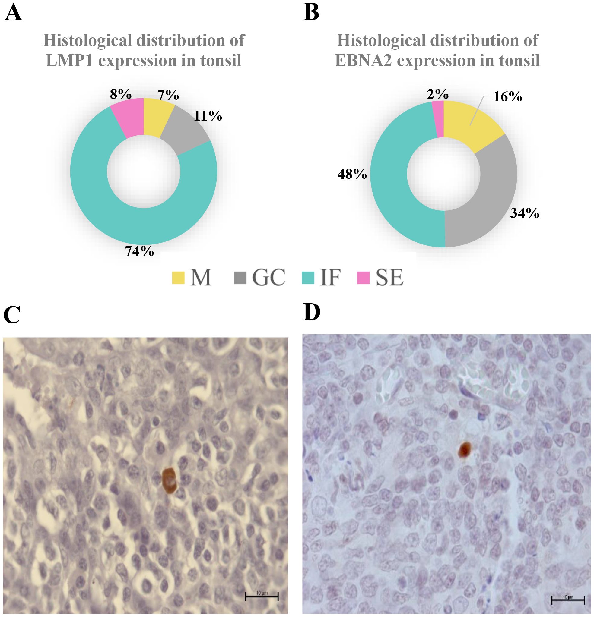 A composite image includes two charts and two histological images. Chart A shows the histological distribution of LMP1 expression in tonsil with 74% in IF, 11% in GC, 8% in M, and 7% in SE. Chart B shows EBNA2 expression with 48% in GC, 34% in IF, 16% in M, and 2% in SE. Image C reveals a histological slide with brown stainingon one cell, indicating LMP1 expression, and Image D shows a similar histological slide with EBNA2 expression. Scale bars are included for reference.