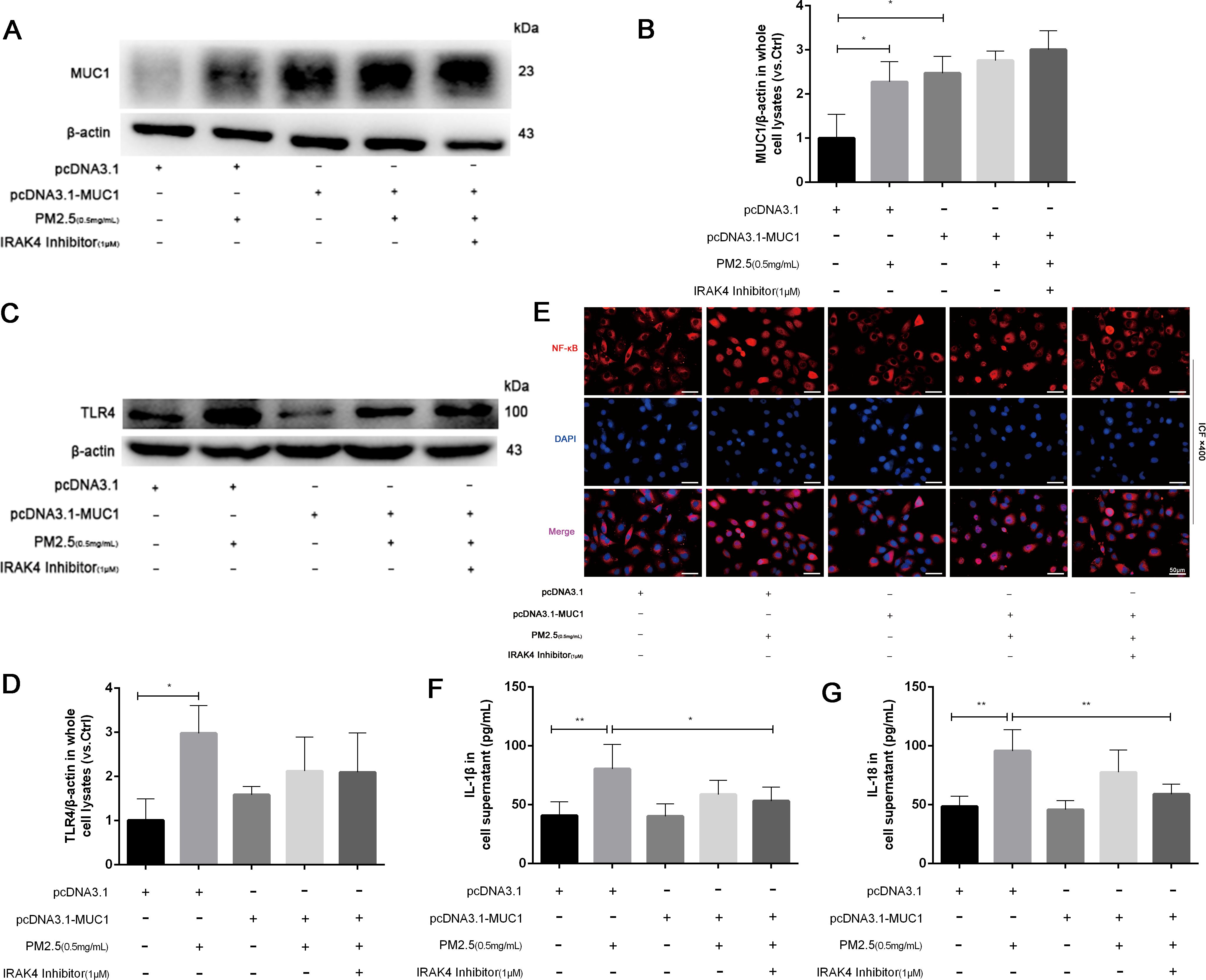 Western blot and bar graphs display MUC1, TLR4, and IL-1 beta expression with various treatments, including pcDNA3.1, pcDNA3.1-MUC1, PM2.5, and IRAK4 inhibitor. Immunofluorescence images show NF-kB and DAPI staining in cells under different conditions. Statistical significance is indicated by asterisks.