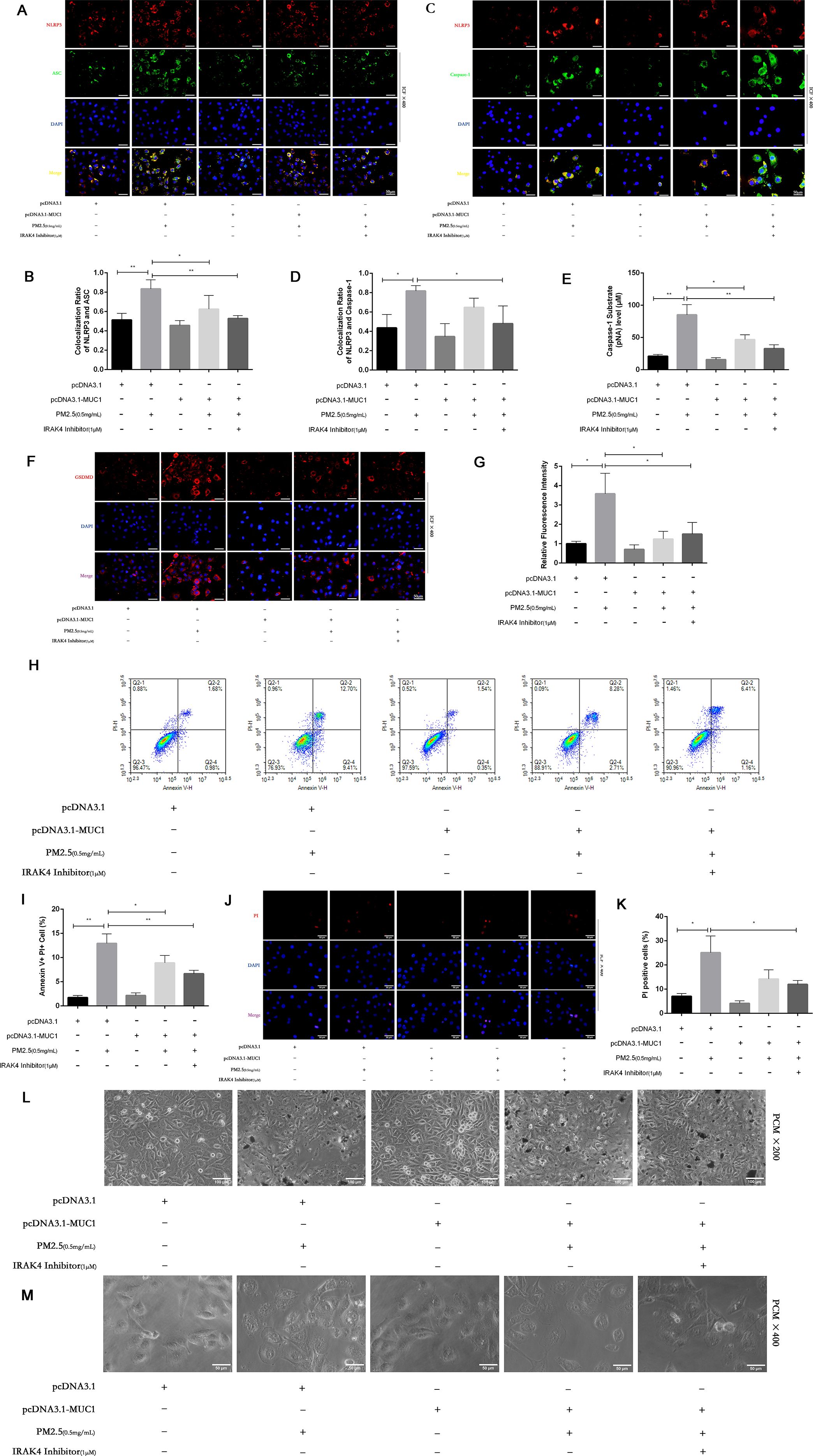 A multi-panel scientific figure illustrating various experiments. Panel A shows fluorescent microscopy images depicting the expression of proteins using different stains and merge overlays. Panels B, D, E, G, I, and K display bar graphs comparing different experiment groups with annotations and significance indicators. Panels C, F, and J show additional fluorescent microscopy images with different protein markers. Panel H presents flow cytometry plots illustrating cell populations under different conditions. Panels L and M include phase-contrast microscopy images showing cell morphology at different magnifications. Experimental conditions and treatments are labeled below each panel.