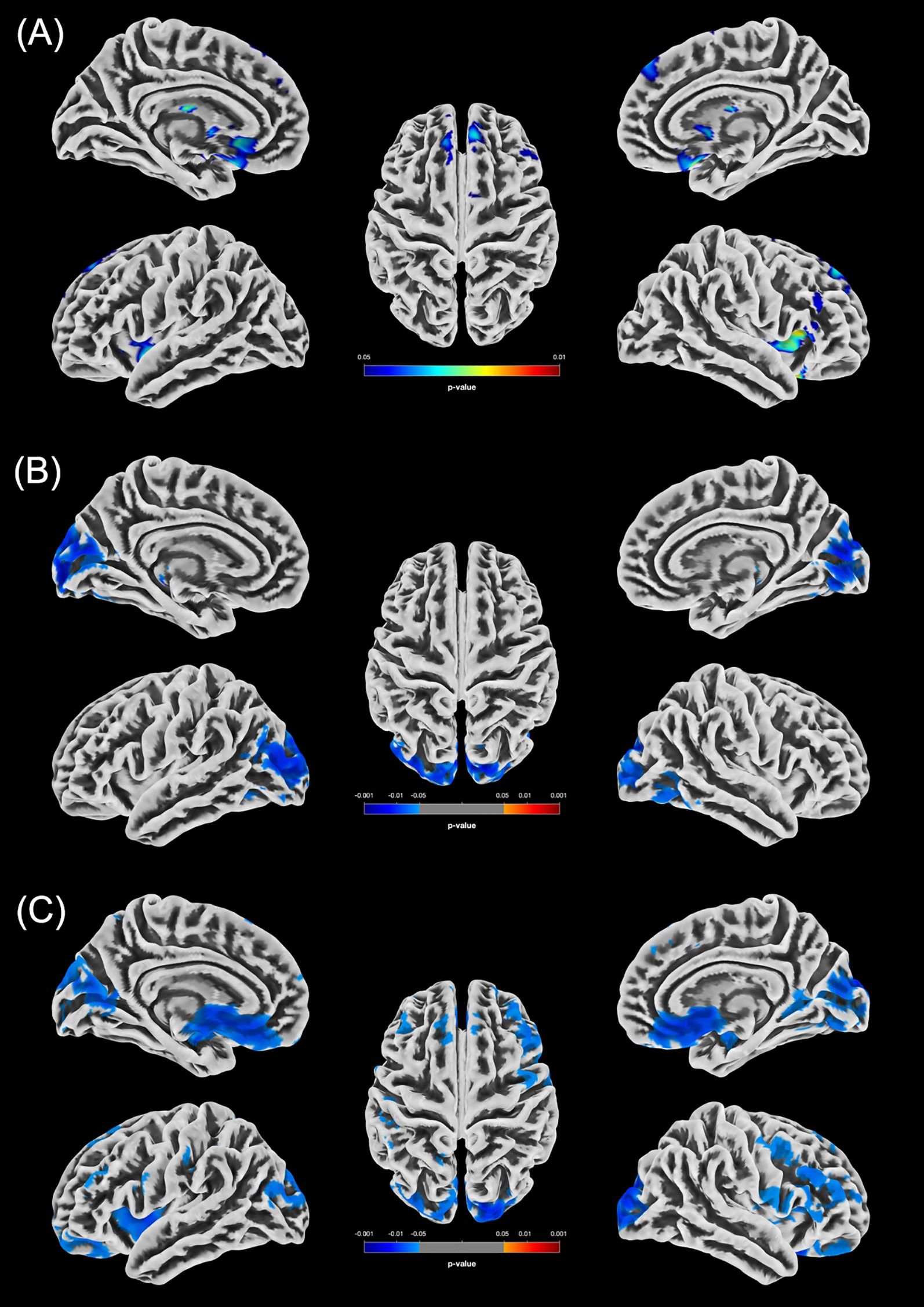 MRI brain scans illustrating statistically significant differences in gray matter volume (GMV) between male groups (p < 0.05, FWE-corrected). Panel A shows increased GMV in m-PCn compared to m-HC (m-HC < m-PCn) in blue/green. Panel B shows reduced GMV in m-PCcog compared to m-HC in blue. Panel C shows increased GMV in m-PCn compared to m-PCcog (m-PCn > m-PCcog) in blue.