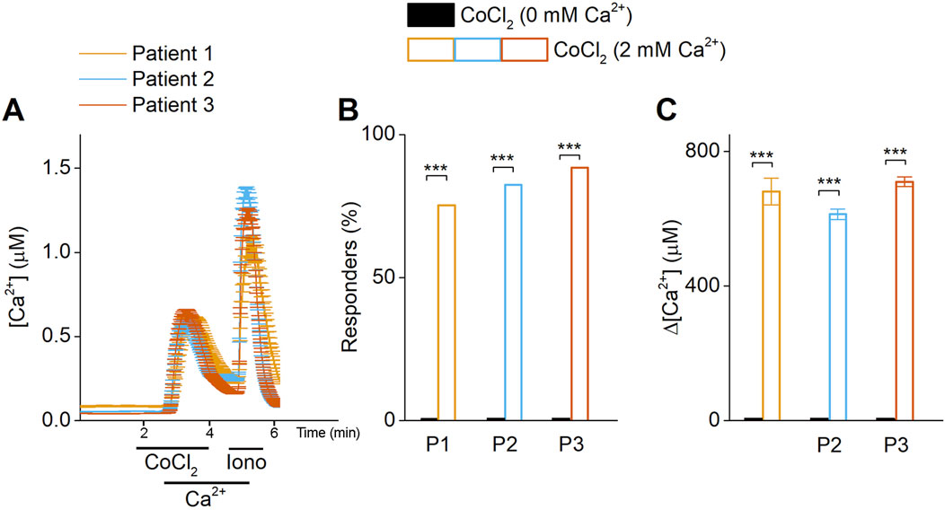 Graph A shows calcium ion concentration over time for Fibroblasts obtained from three patients with similar response patterns. Graph B presents the percentage of responders for each patient, all reaching nearly 100%. Graph C depicts changes in calcium ion concentration, with significant increases for each patient. Legend indicates black represents CoCl₂ without calcium and colors represent CoCl₂ with 2 mM calcium. Significant differences are marked by asterisks (***).