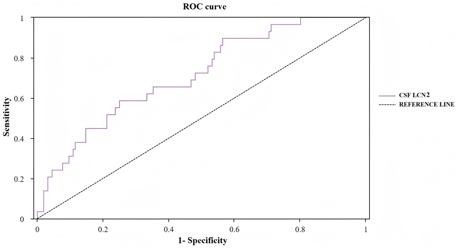 ROC curve graph showing the performance of CSF LCN2. The curve is purple and steps upward, indicating the sensitivity and specificity across different thresholds. The black dashed line represents the reference line. The x-axis is labeled "1 - Specificity" and the y-axis "Sensitivity."