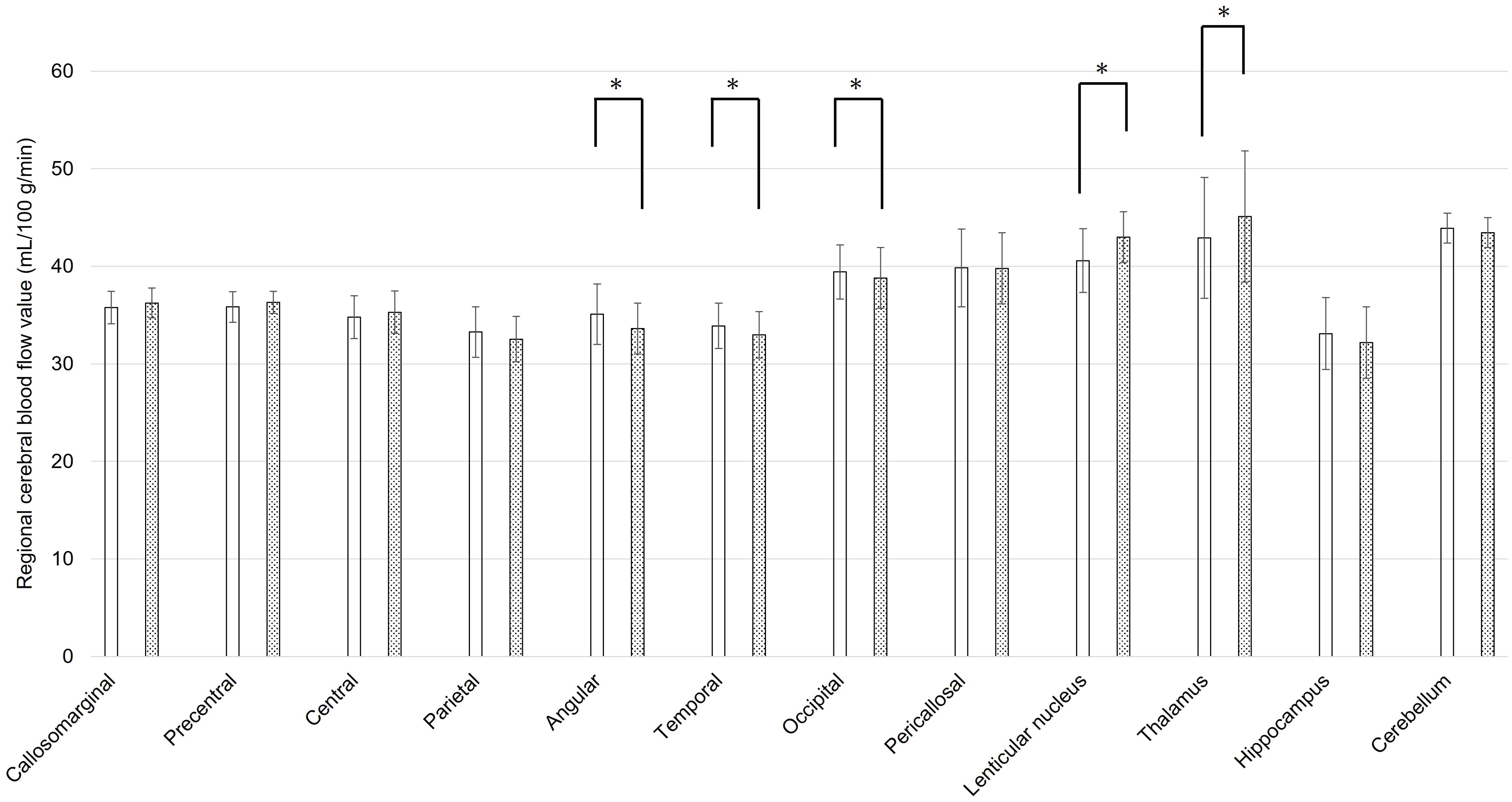 Bar graph showing regional cerebral blood flow values (mL/100 g/min) across different brain regions: Callosomarginal, Precentral, Central, Parietal, Angular, Temporal, Occipital, Pericallosal, Lenticular nucleus, Thalamus, Hippocampus, and Cerebellum. Error bars indicate variability. Significant differences are marked with asterisks.