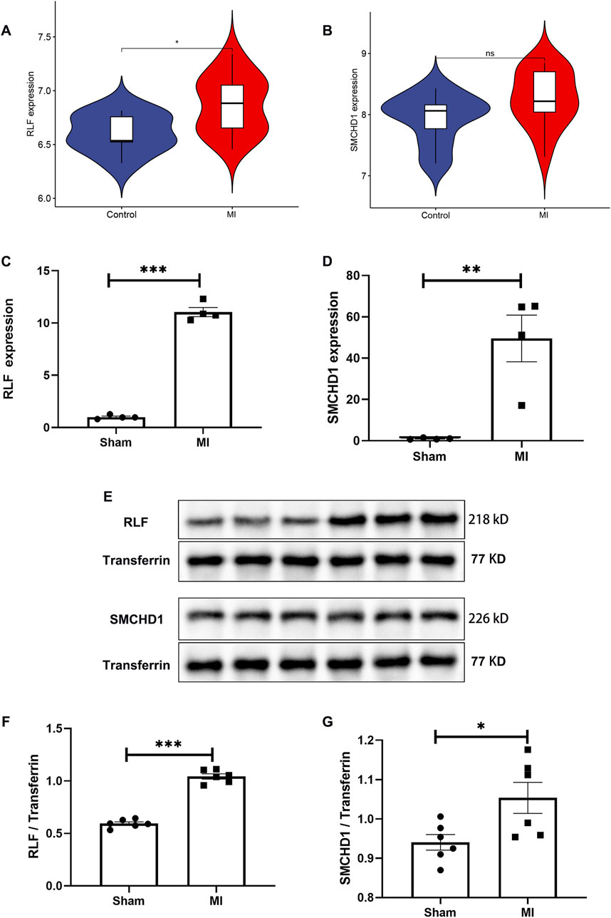Violin plots and bar graphs depict RLF and SMCHD1 expression differences between control, sham, and myocardial infarction (MI) groups. The MI group shows increased RLF expression (A, C) with significant differences indicated by asterisks, and elevated SMCHD1 expression (B, D). Western blot images (E) show protein expression levels of RLF and SMCHD1 with transferrin as a loading control. Bar graphs (F, G) show the ratios of RLF and SMCHD1 to transferrin, highlighting significant increases in the MI group compared to sham.