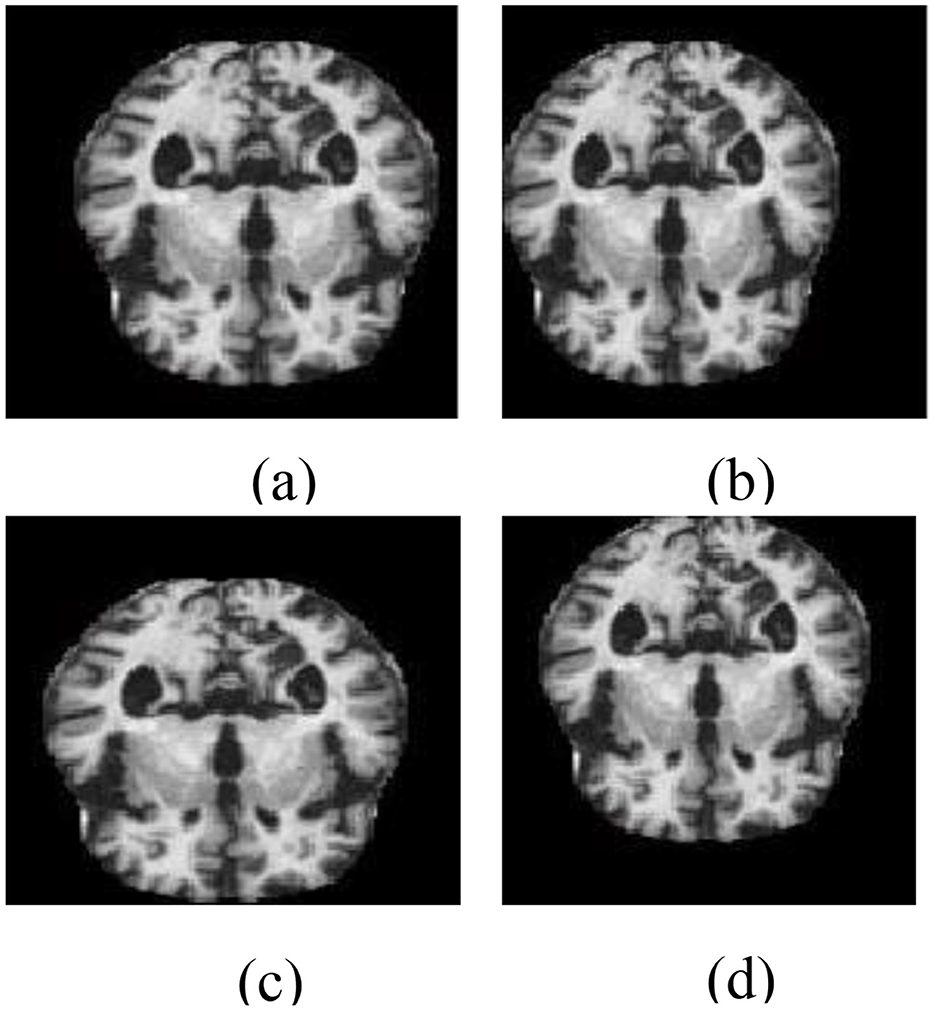 Flowchart depicting a convolutional neural network (CNN) for brain image classification. The process begins with DA Brain Image, followed by layers: Con_lay1 (32, 3x3), Pool_lay1, Con_lay2 (64, 5x5), Pool_lay2, Con_lay3 (128, 5x5), Con_lay4 (256, 3x3), Con_lay5 (512, 5x5), and Pool_lay3. The final output connects to FCNN layers, leading to Classification Results.