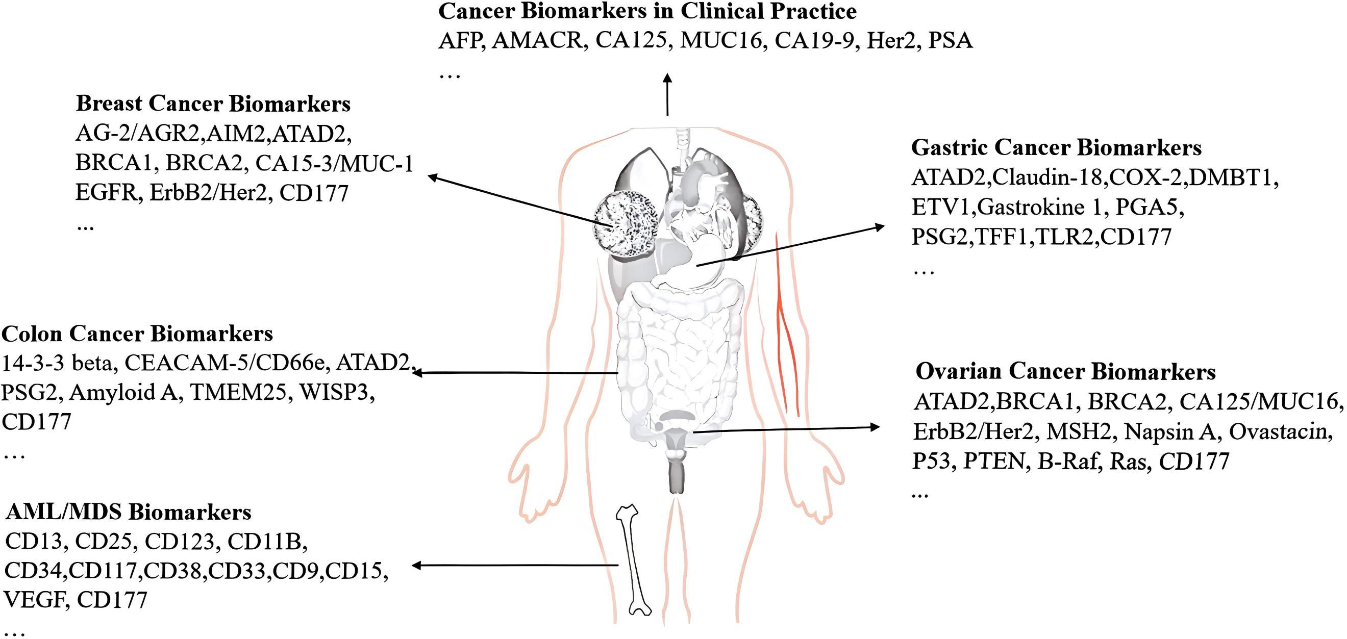 Diagram listing cancer biomarkers related to different types of cancer alongside a human figure. Categories include Breast, Colon, Gastric, Ovarian cancers, and Acute Myeloid Leukemia/Myelodysplastic Syndromes (AML/MDS). Each category is linked to the human body with specific biomarkers such as AG-2, ATAD2, BRCA1, CA125, CD177, among others. The image visually connects these biomarkers to relevant anatomical regions.