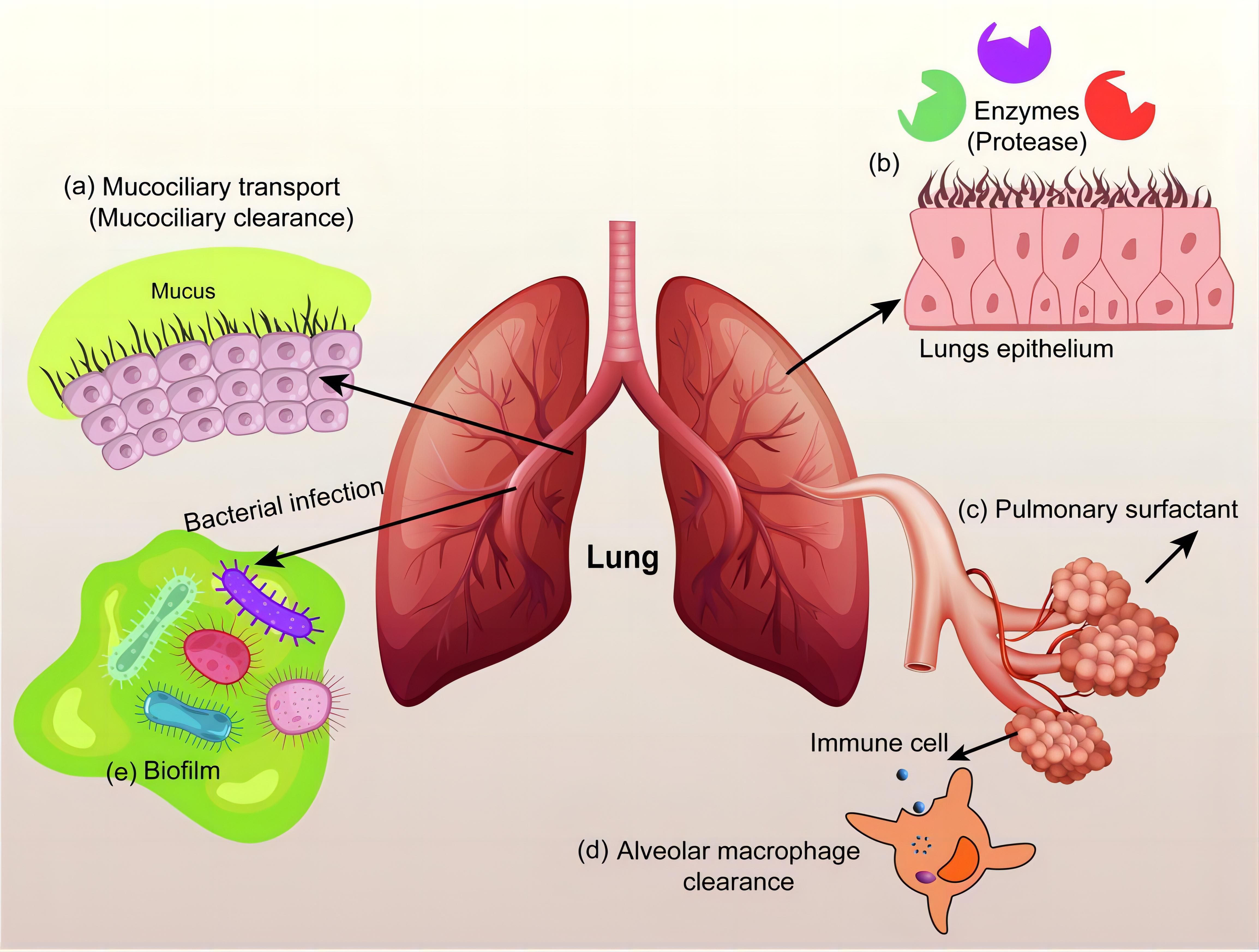 Illustration of lung defenses against bacterial infection. It shows mucociliary transport, lung epithelium with enzymes, pulmonary surfactant, alveolar macrophage clearance by immune cells, and biofilm formation.