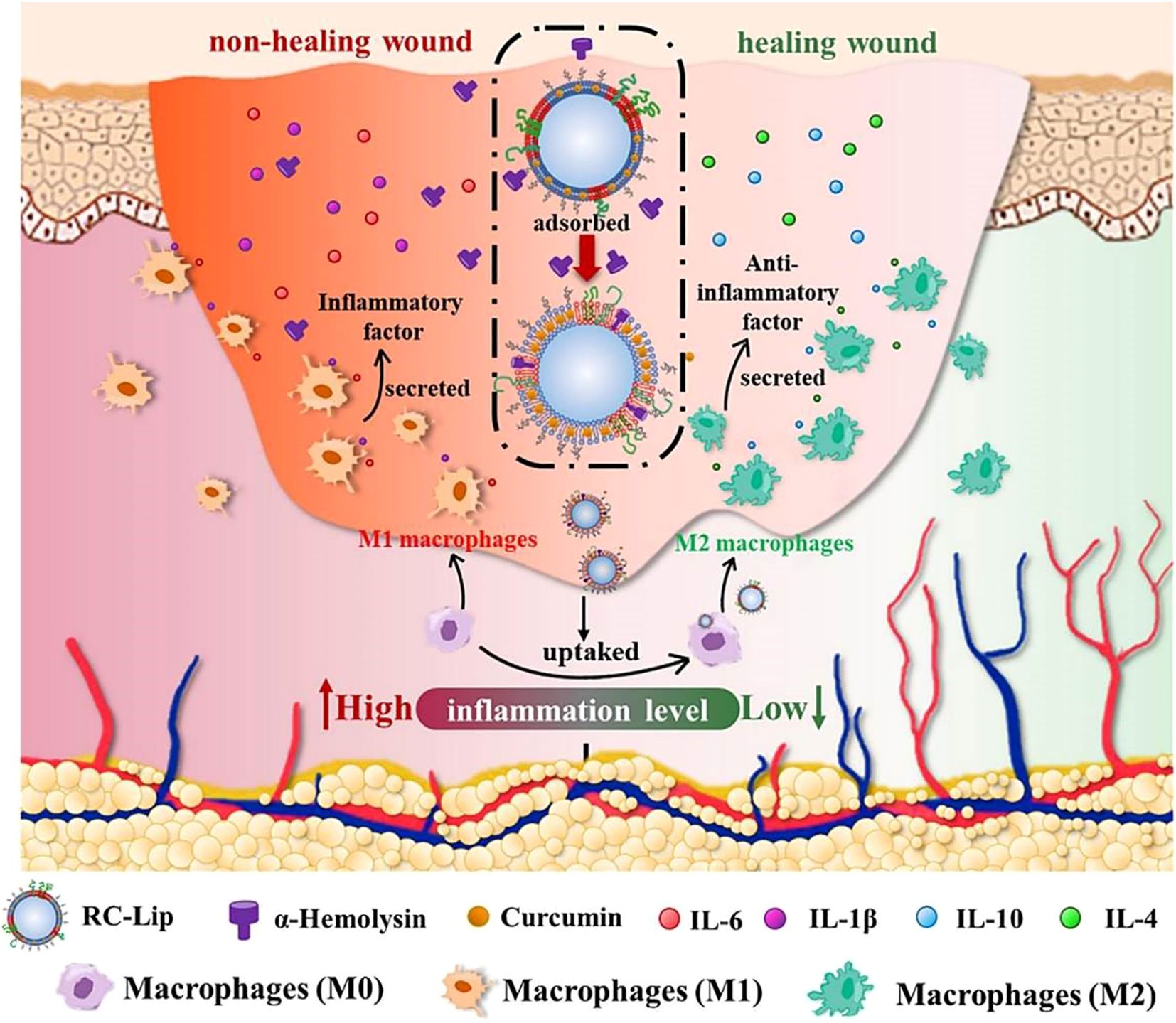 Illustration showing a comparison between non-healing and healing wounds. On the left, a non-healing wound has M1 macrophages secreting inflammatory factors, indicated by high inflammation levels. On the right, a healing wound features M2 macrophages secreting anti-inflammatory factors, indicating low inflammation. Central particles, labeled RC-Lip, are shown being taken up by macrophages. The diagram also includes elements like curcumin, alpha-hemolysin, and cytokines IL-6, IL-1β, IL-10, and IL-4, with arrows illustrating processes of adsorption, secretion, and uptake. A legend at the bottom explains the symbols.