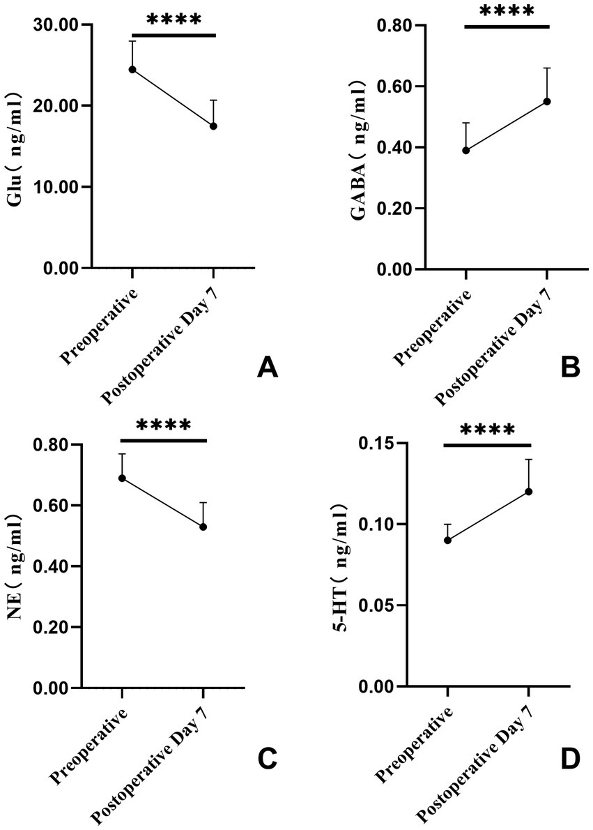 Line graphs showing levels of neurotransmitters before and after surgery. Panel A displays a significant decrease in Glu levels from about 27 to 20 nanograms per milliliter. Panel B shows a significant increase in GABA levels from about 0.4 to 0.6 nanograms per milliliter. Panel C illustrates a significant decrease in NE levels from about 0.75 to 0.55 nanograms per milliliter. Panel D shows a significant increase in 5-HT levels from about 0.08 to 0.12 nanograms per milliliter. Significance is indicated by four asterisks.