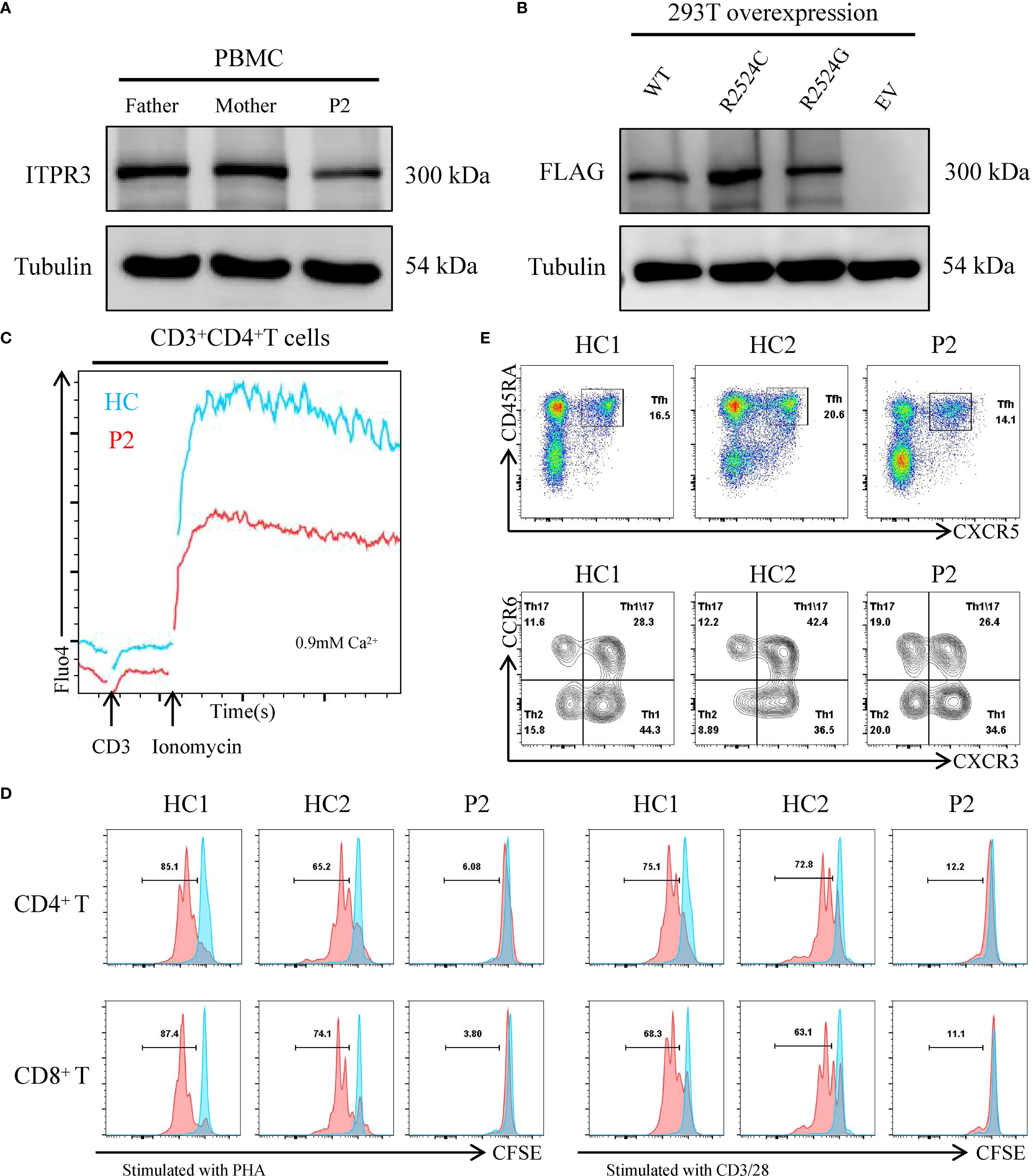 Western blots and flow cytometry analyses highlight protein expression and cell activity. Panel A shows ITPR3 and tubulin levels in PBMC from family members. Panel B presents FLAG-tagged protein expression in 293T cells. Panel C graphs CD3+CD4+ T cell calcium flux in P2 versus a healthy control. Panel D illustrates CFSE-stained CD4+ and CD8+ T cells after PHA or CD3/28 stimulation. Panel E depicts flow cytometry plots of Tfh and Th17 cell populations in HC1, HC2, and P2.