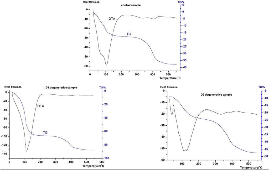 Three thermogravimetric analysis (TGA) and differential thermal analysis (DTA) graphs display heat flow against temperature for different samples. The top graph shows a control sample, with heat flow dipping significantly around 100°C and weight loss decreasing steadily. The bottom left graph is for the D1 degenerative sample, showing a deeper heat flow dip at approximately 100°C and more pronounced weight loss. The bottom right graph represents the D2 degenerative sample, illustrating a similar trend to D1 with marked heat flow and weight changes.