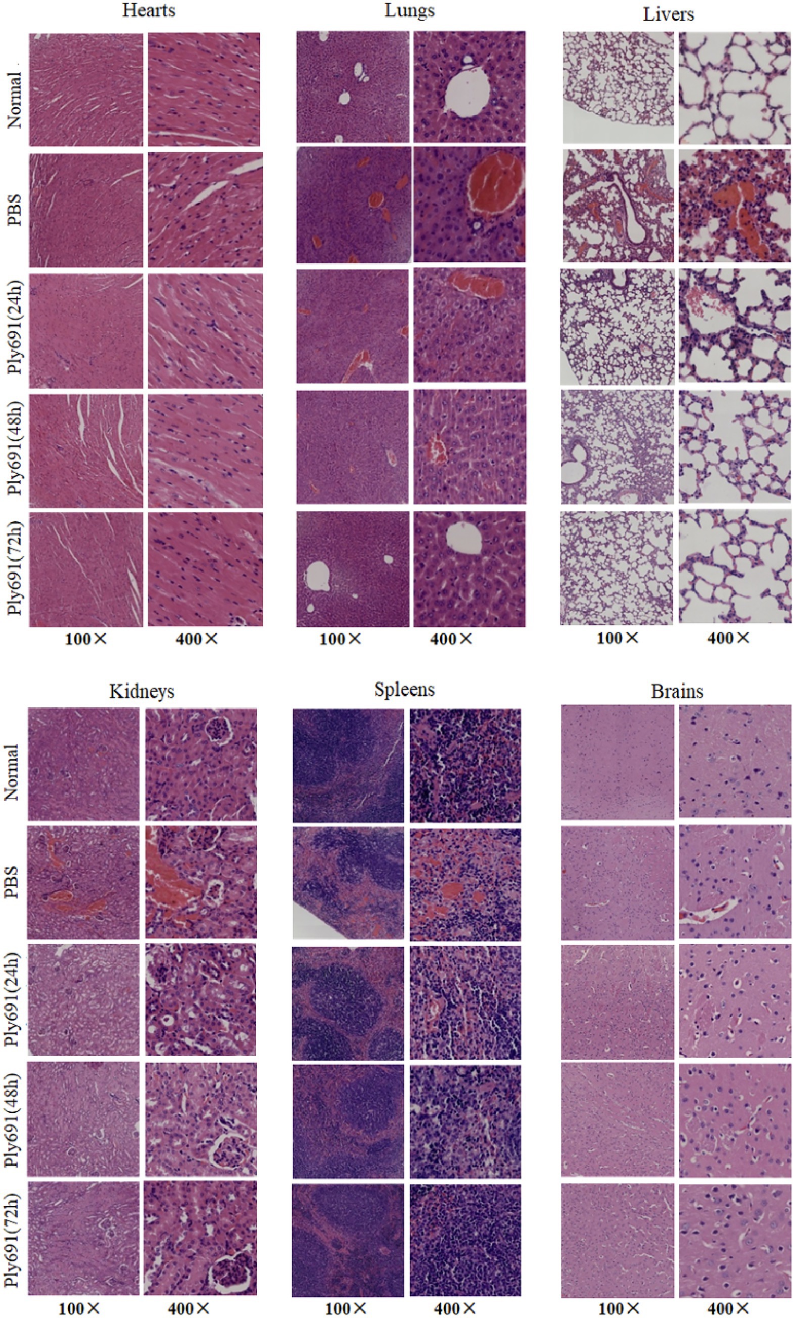 Histological images showing tissues from hearts, lungs, livers, kidneys, spleens, and brains under different conditions: Normal, PBS, and Ply691 at 24, 48, and 72 hours. Each tissue is shown at 100x and 400x magnifications, displaying cellular details and structural changes under each condition.