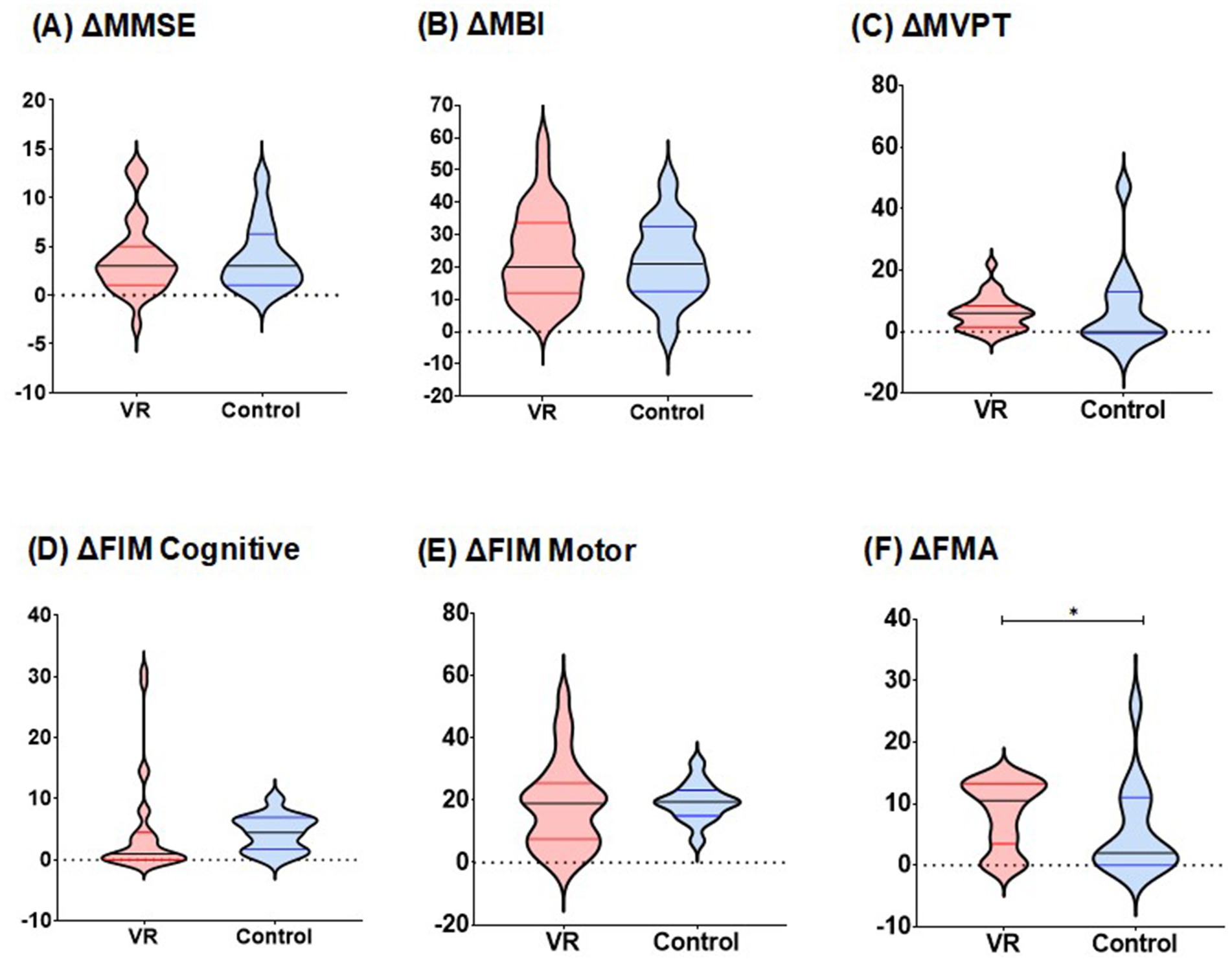 Six violin plots comparing changes in cognitive and motor assessments between the VR group (red) and the Control group (blue). (A) ΔMMSE, (B) ΔMBI, (C) ΔMVPT, (D) ΔFIM Cognitive, and (E) ΔFIM Motor showed no significant differences in medians or interquartile ranges between groups. (F) ΔFMA demonstrated significant differences in medians and interquartile ranges between groups, with higher results observed in the VR group.