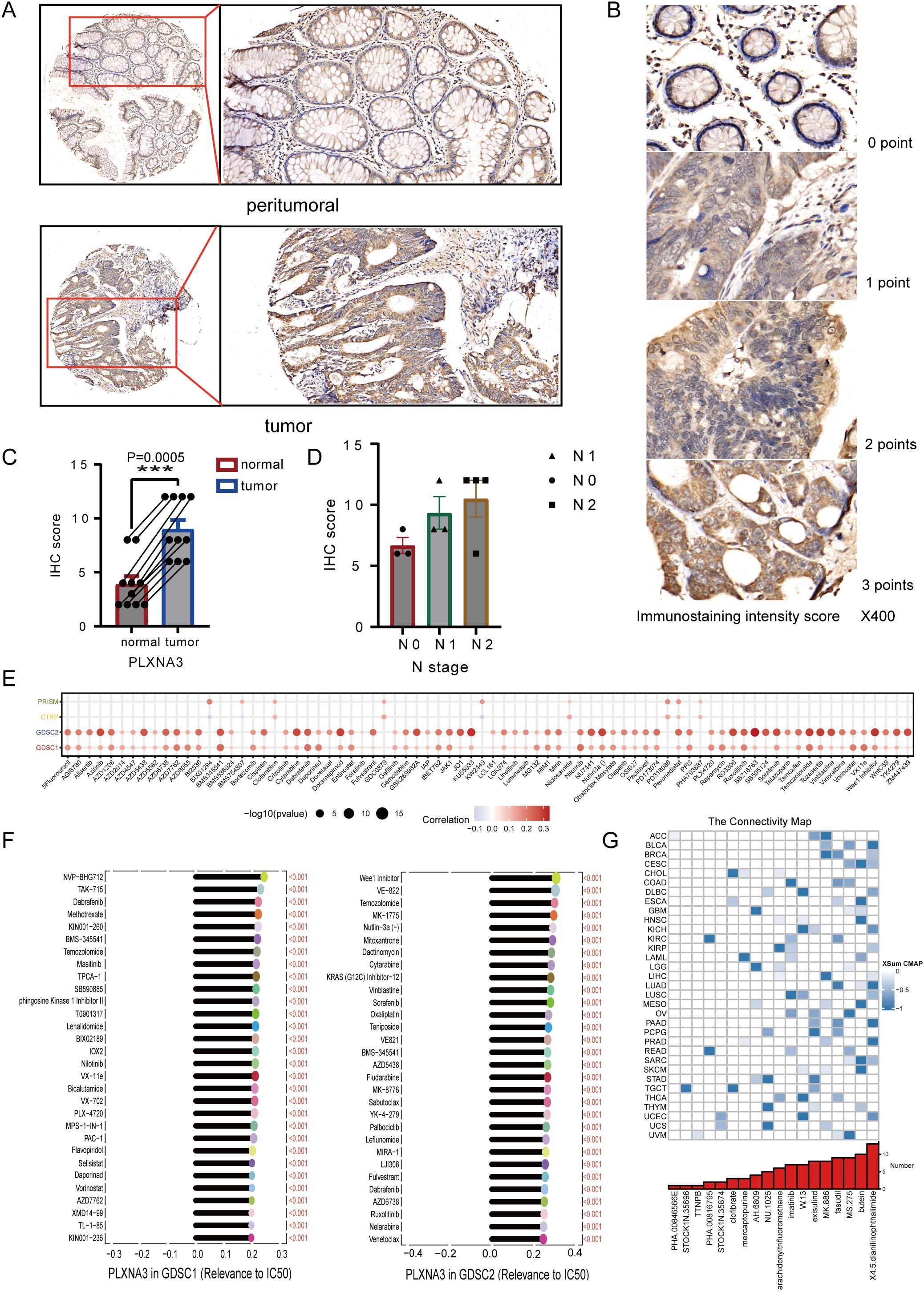 Histological analysis shows peritumoral and tumor tissue sections with immunostaining in panel A. Panel B provides an immunostaining intensity score from zero to three points, shown at X400 magnification. Panel C presents a bar graph comparing IHC scores between normal and tumor samples, indicating higher scores in tumors with a P value of 0.0005. Panel D shows IHC scores based on N stage, denoting various disease stages. Panel E displays a correlation plot for gene expression. Panel F offers drug relevance graphs for PLXNA3 in GDSC1 and GDSC2 datasets. Panel G includes a connectivity map highlighting gene interactions across different cancers.
