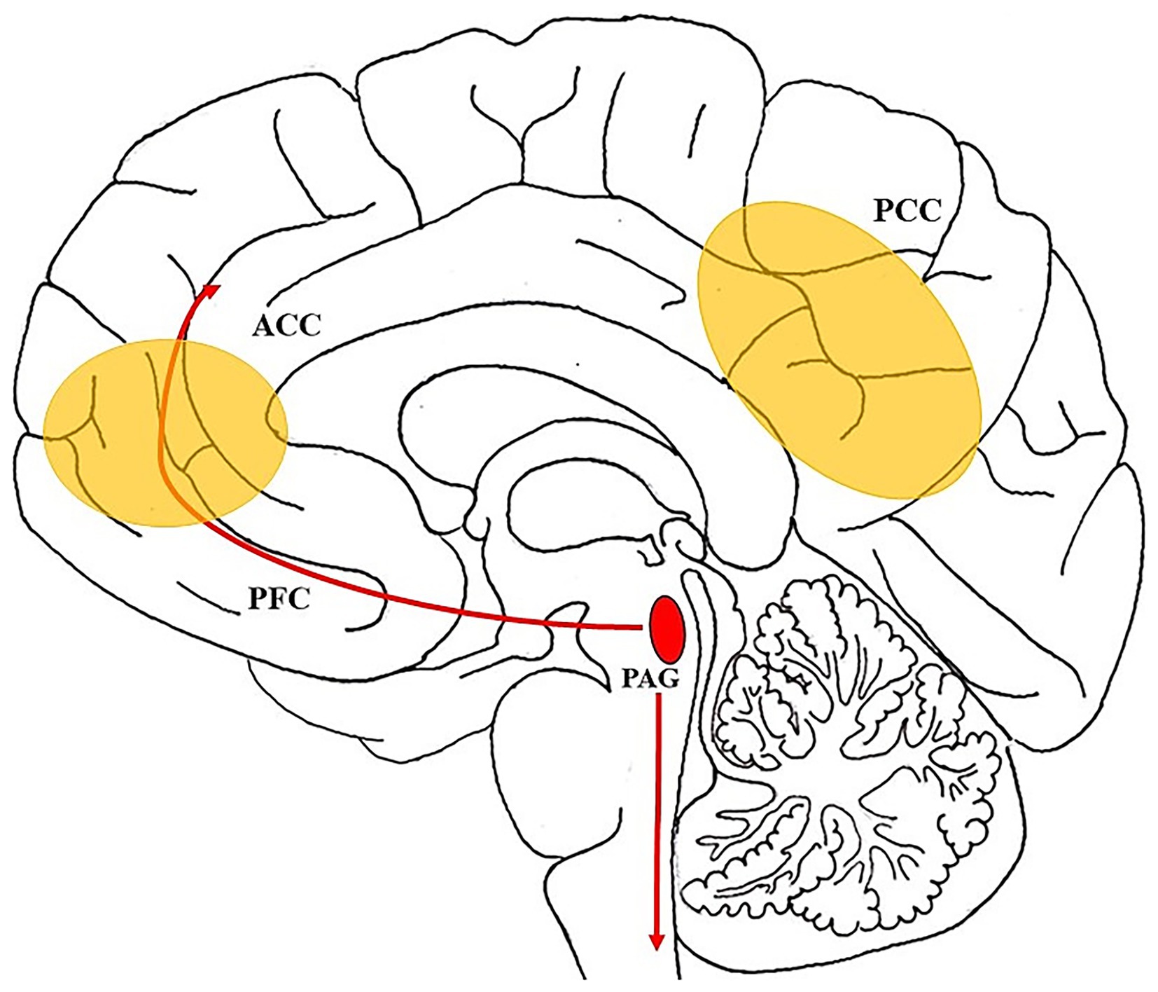 Illustration of a brain diagram highlighting specific areas. Yellow ovals indicate the anterior cingulate cortex (ACC) and posterior cingulate cortex (PCC). The path from the prefrontal cortex (PFC) to the periaqueductal gray (PAG) is marked with red arrows, showing neural pathways.