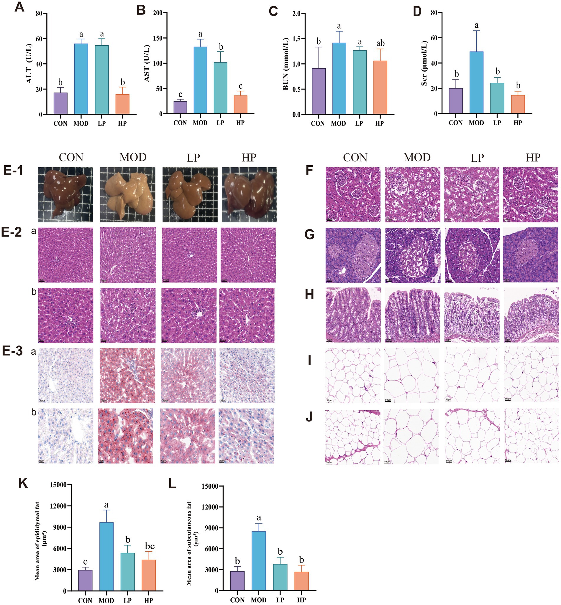 Bar graphs (A-D) show enzyme levels for ALT, AST, BUN, and Scr across four groups: CON, MOD, LP, HP. Microscopic images (E-J) depict liver and intestinal tissues with staining variations under different conditions. Additional bar graphs (K-L) display mean fat area measurements for epididymal and omental fat. Each group shows distinct variations in tissue structure and enzyme levels, indicating different physiological responses among experimental conditions.
