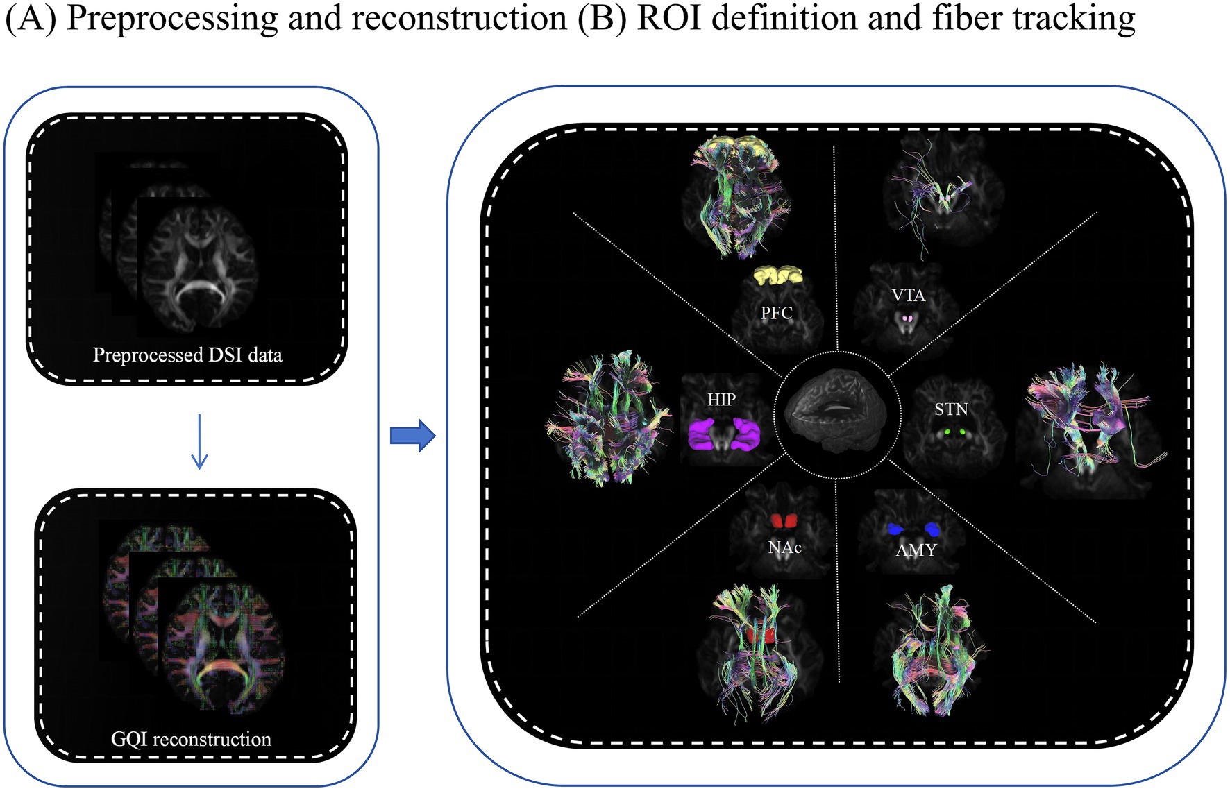 Diagram showing preprocessing and reconstruction in brain imaging. On the left, preprocessed DSI data leads to GQI reconstruction. On the right, brain regions are highlighted: PFC, VTA, STN, HIP, NAc, and AMY, with fiber tracking visuals radiating from a central axial brain slice.
