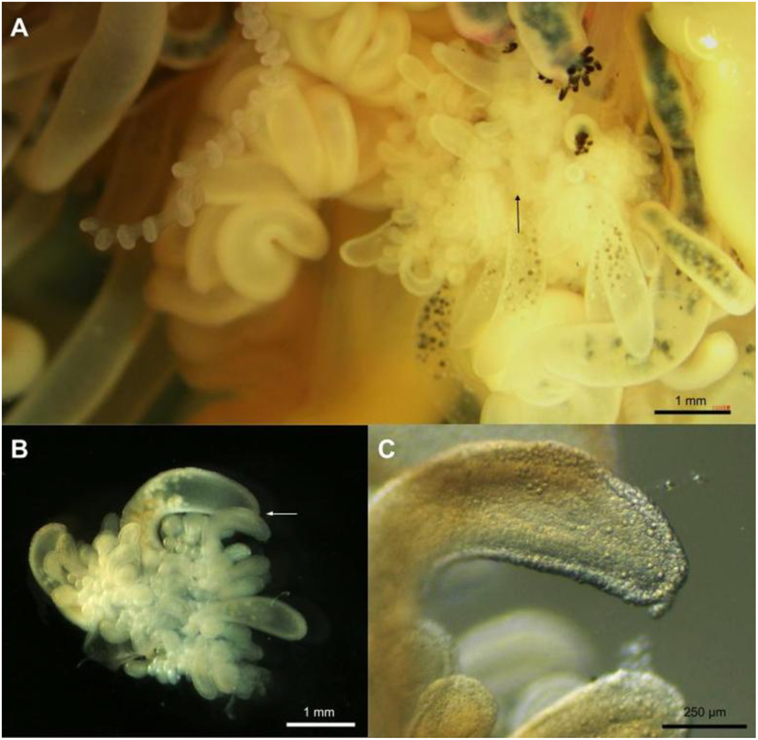 Three microscopic images of Portuguese man o' war jellyfish. A: Close-up of reproductive structure of Portuguese man o' war jellyfish. B: Detailed view of gonodendron branch. C: Magnified section of a palpon of Portuguese man o' war jellyfish reproductive structure, highlighting nematocysts on the palpon and detail. Scale bars indicate sizes.