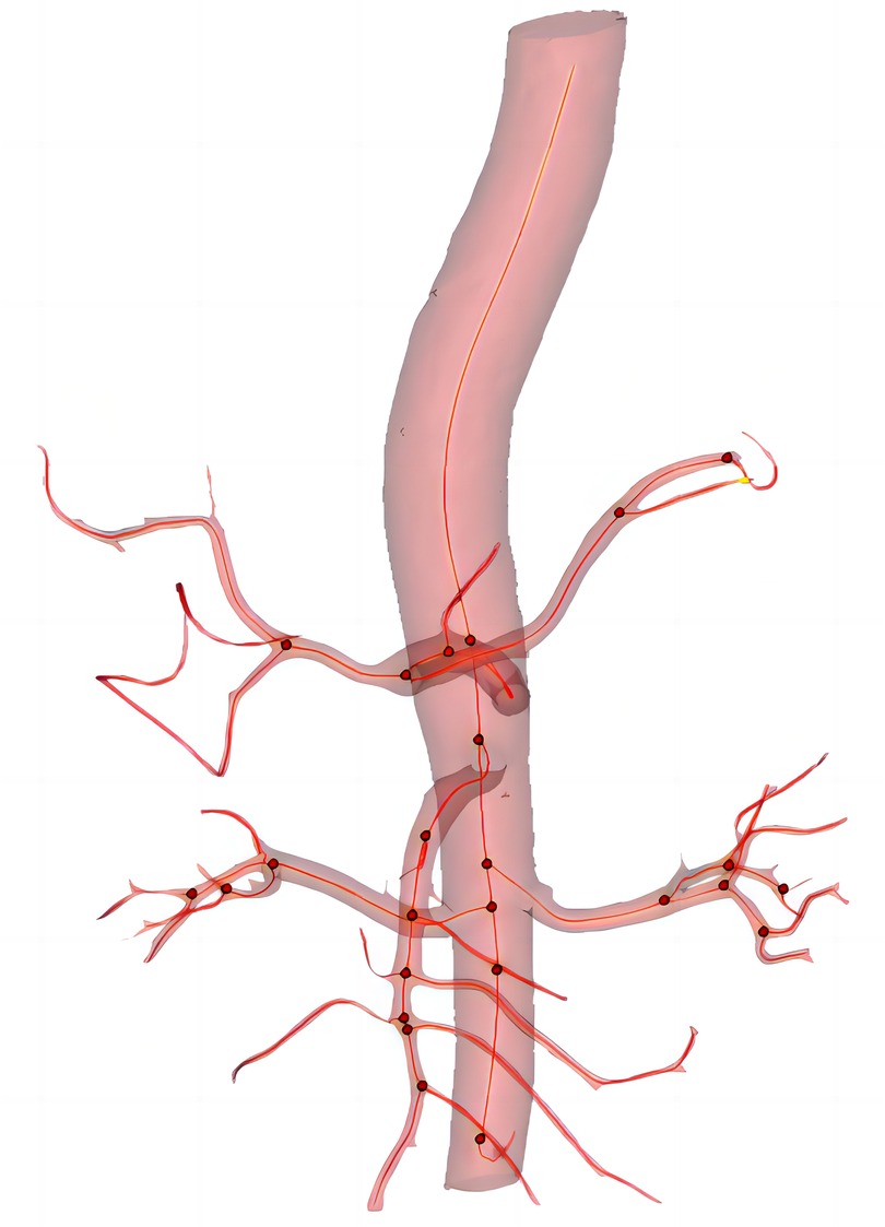 Illustration of a human artery with branching blood vessels, depicted in red. The main artery is highlighted in pink, showcasing a network of smaller vessels diverging outwards. Red dots are marked at various branching points.
