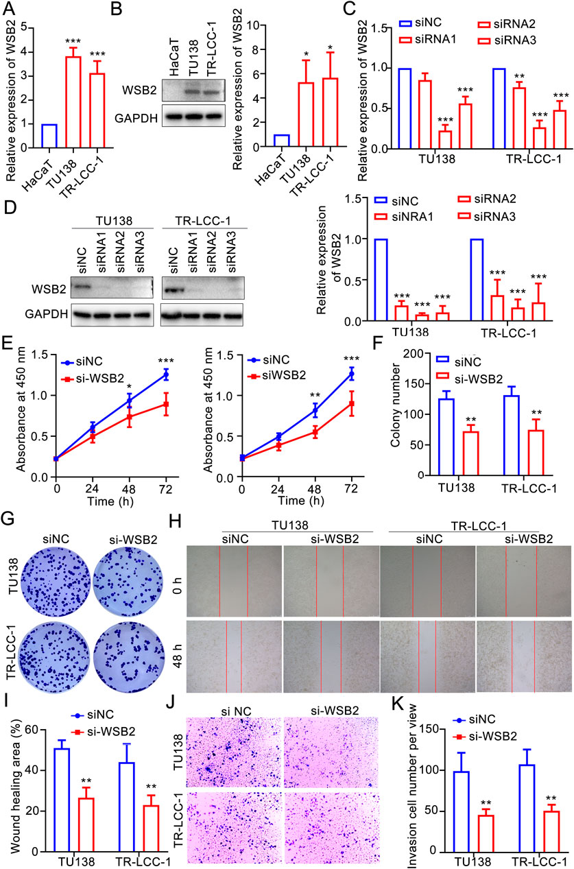 Graphs, western blots, and microscopy images depict the effects of WSB2 expression in TU138 and TR-LCC-1 cells. Bar graphs (A, C, F, I, K) show expression and assay results with siRNA treatments, highlighting significant differences. Western blots (B, D) display protein levels of WSB2 and GAPDH. Line graphs (E) indicate cell viability over time. Colony formation assays (G) and wound healing assays (H) compare control siNC and siWSB2 treatments. Microscopy images (J) display cell invasion. Statistical significance is marked with asterisks.
