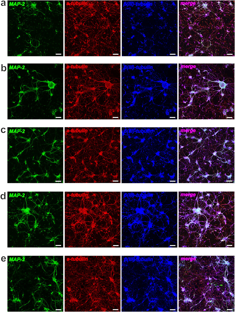 Five panels labeled a to e, each containing four images showing immunofluorescent staining of neuronal cells. Each panel features staining for MAP-2 in green, α-tubulin in red, β(III)-tubulin in blue, and a merged image showing all three stains combined. The stains highlight neuronal structures and provide information on cellular organization. Scale bars are present.