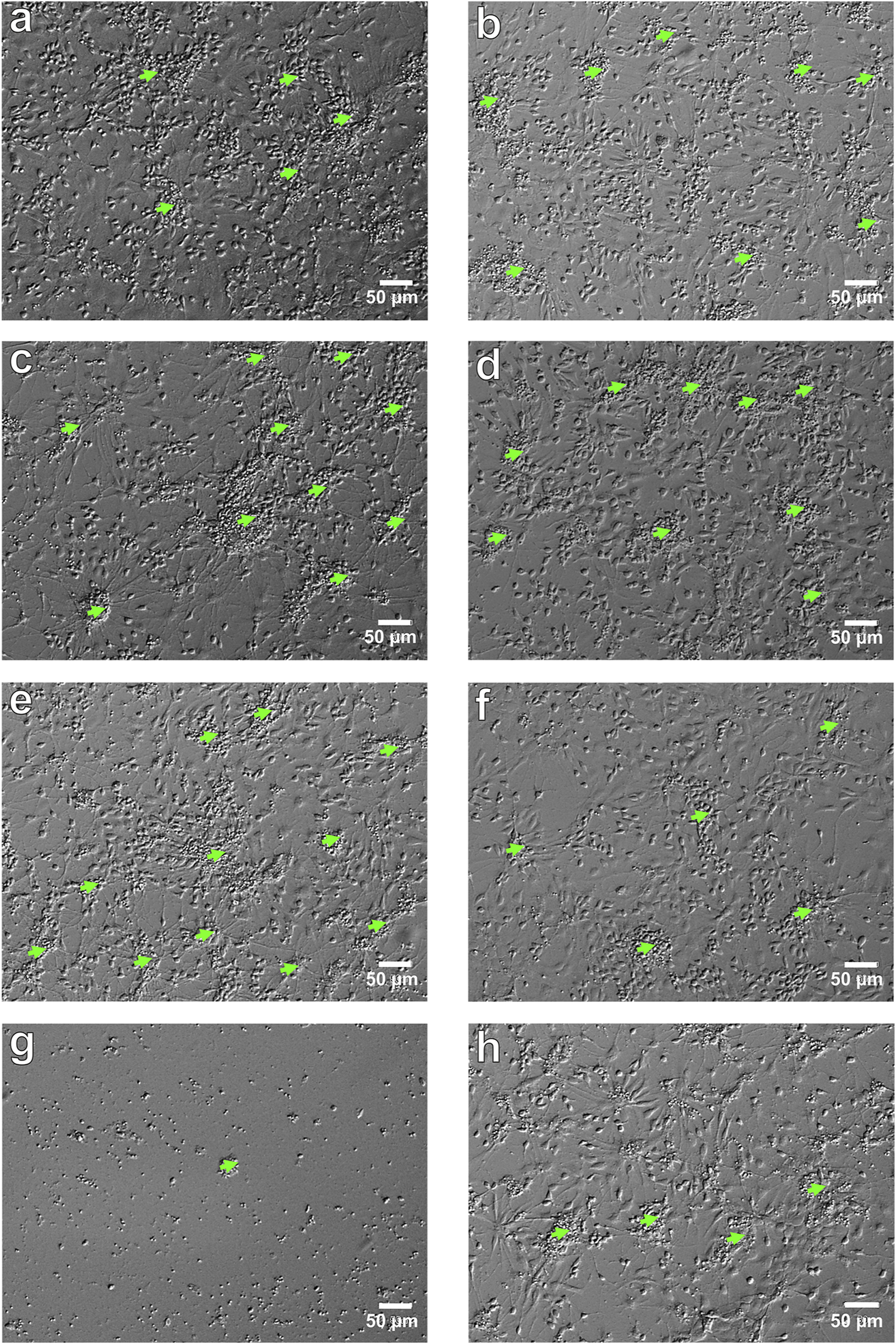 A series of microscopic images labeled a to h, showing gray backgrounds with small, green fluorescent spots distributed across each panel. Each image includes a scale bar indicating fifty micrometers. The density and arrangement of the spots vary between images.