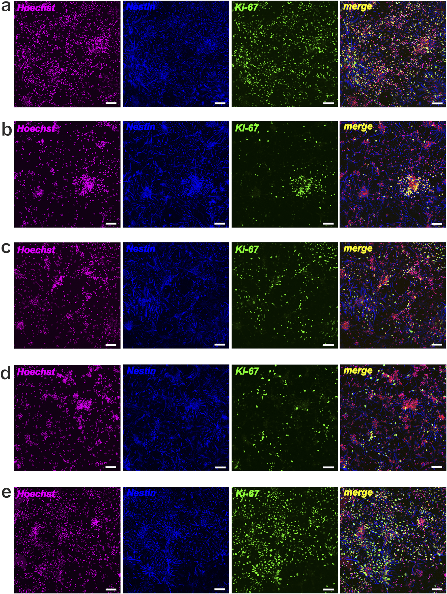 Fluorescent microscopy images labeled a to e. Each set includes four panels: Hoechst (magenta) shows nuclear staining; Nestin (blue) indicates neural stem cells; KI-67 (green) marks proliferating cells; and a merged image. The merged image combines all stains, highlighting cell distribution and proliferation status.