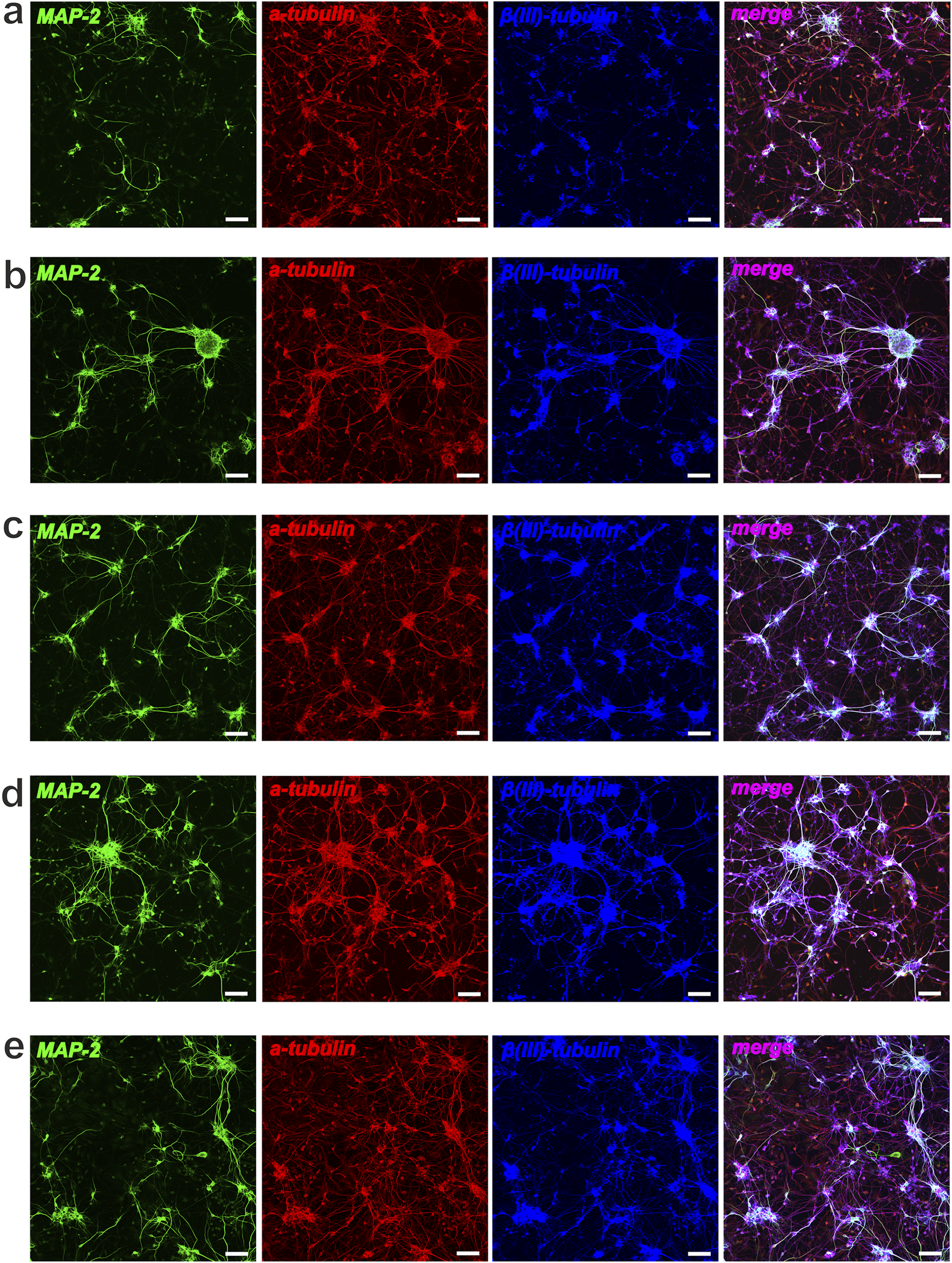 Five panels labeled a to e, each containing four images showing immunofluorescent staining of neuronal cells. Each panel features staining for MAP-2 in green, α-tubulin in red, β(III)-tubulin in blue, and a merged image showing all three stains combined. The stains highlight neuronal structures and provide information on cellular organization. Scale bars are present.