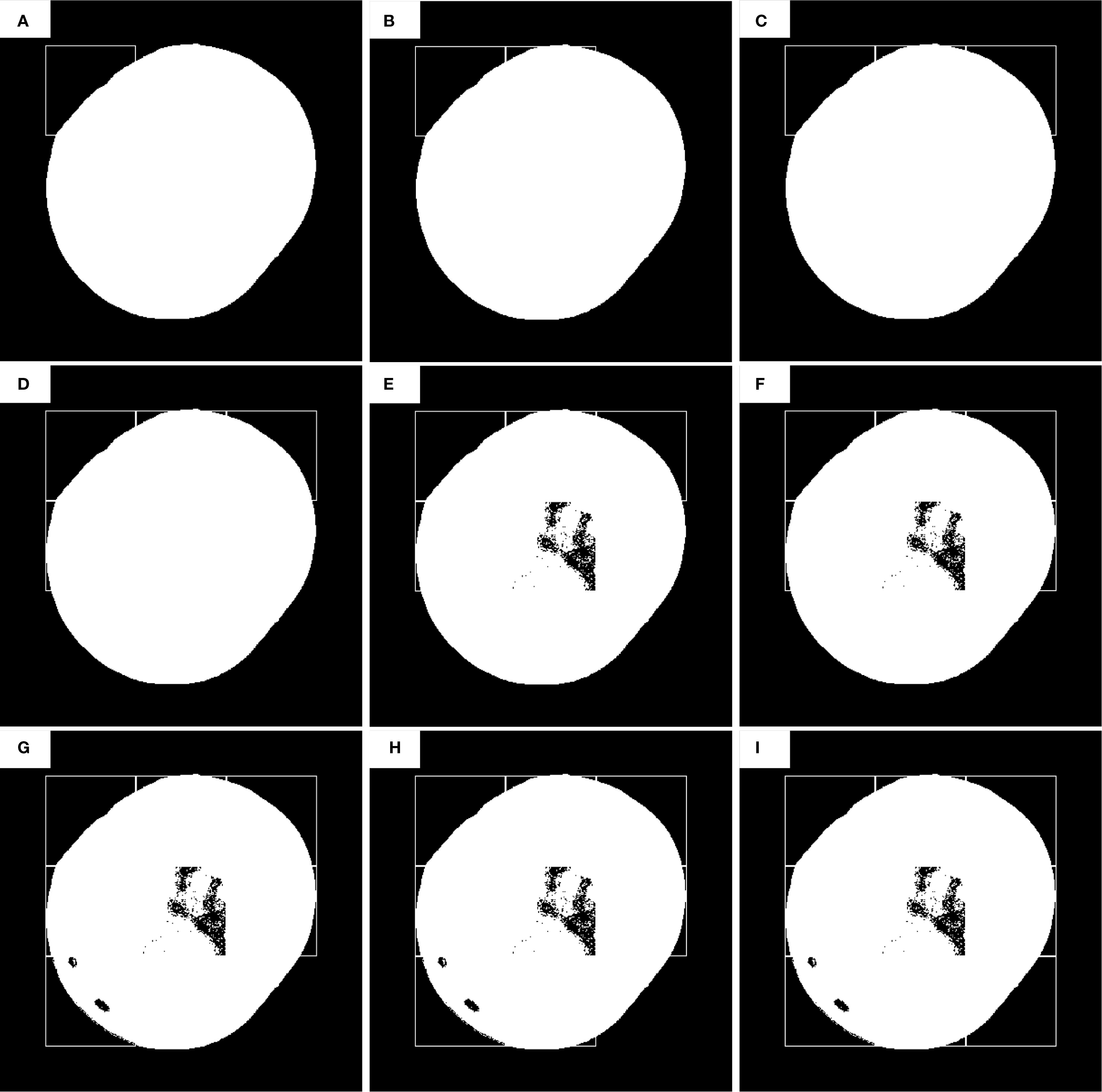 Nine-panel image showing variations in grayscale patterns within circular regions labeled A to I. Panels A, B, C, and D appear mostly blank, with subtle differences. Panels E, F, G, H, and I display increasing amounts of black speckled patterns within the circular shape, particularly in the center region. The background is black, while the circular areas are white.