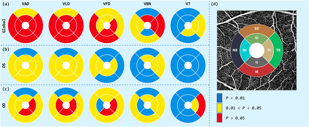 Circular diagrams represent data comparisons for categories VAD, VLD, VFD, VBN, and VT, with sections colored red, yellow, and blue, indicating statistical significance levels. Sections are labeled as Global, OS, and OD. Panel (d) displays a segmented circular chart over a grayscale background with labels SE, SI, TE, IE, II, NI, and NE. A key indicates blue for P < 0.01, yellow for 0.01 < P < 0.05, and red for P > 0.05.
