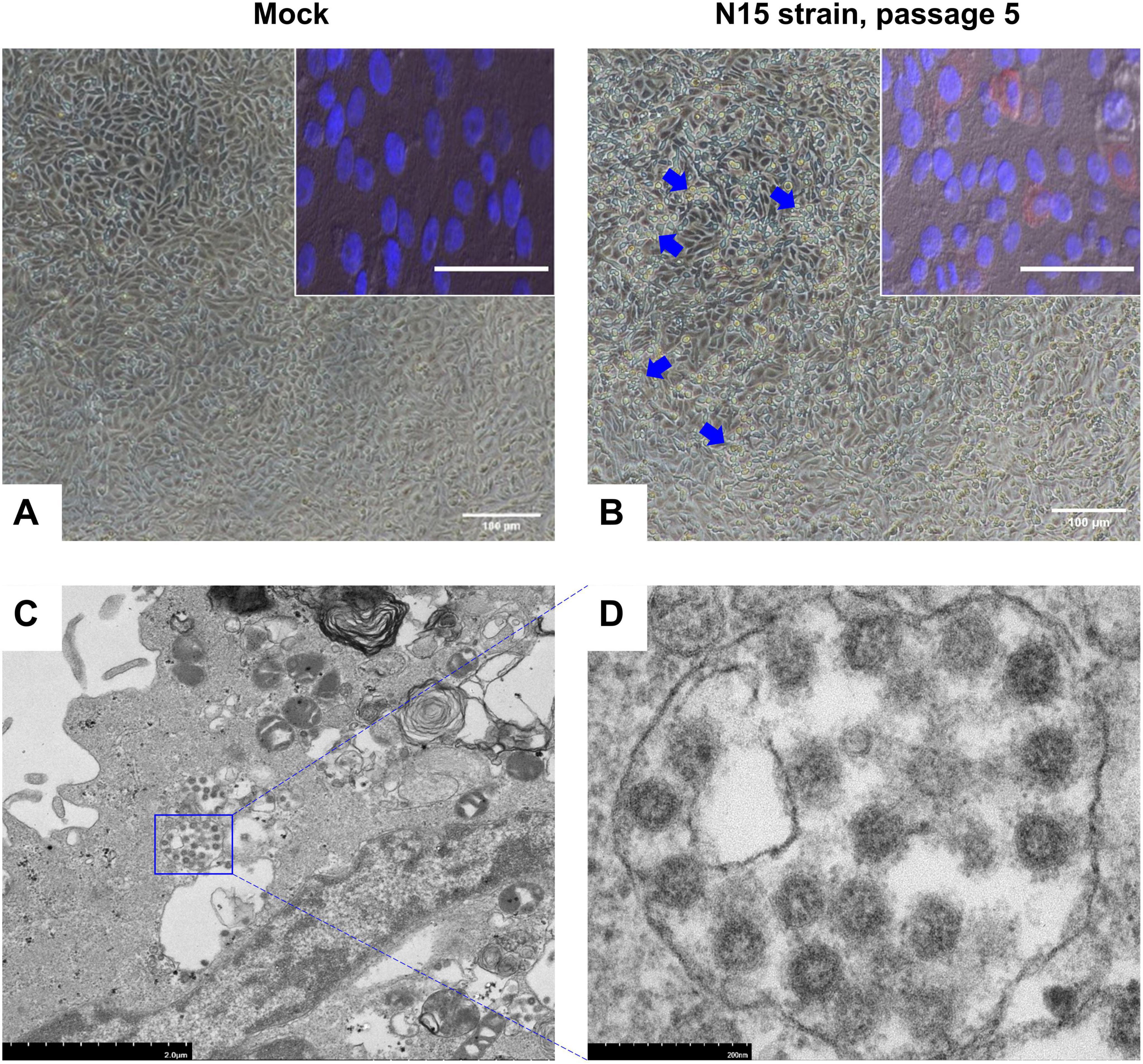 Composite image showing cell cultures under different conditions. Panel A shows cells labeled “Mock” with a close-up of cell nuclei stained blue. Panel B shows cells labeled “N15 strain, passage 5” with slight differences in cell structure, indicated by blue arrows, and a close-up showing blue and red-stained nuclei. Panel C is an electron micrograph of a cell with a marked area. Panel D is a magnified view of the marked area, showing detailed cell structures with dense particles.