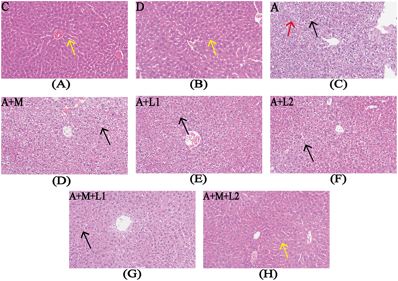 Microscopic images of liver tissue samples labeled with experimental conditions: (A) C with yellow arrow indicating cellular structure, (B) D with yellow arrow, (C) A with red and black arrows, (D) A+M, (E) A+L1, (F) A+L2, (G) A+M+L1, and (H) A+M+L2 with yellow arrow. Variations in tissue morphology and staining are visible.
