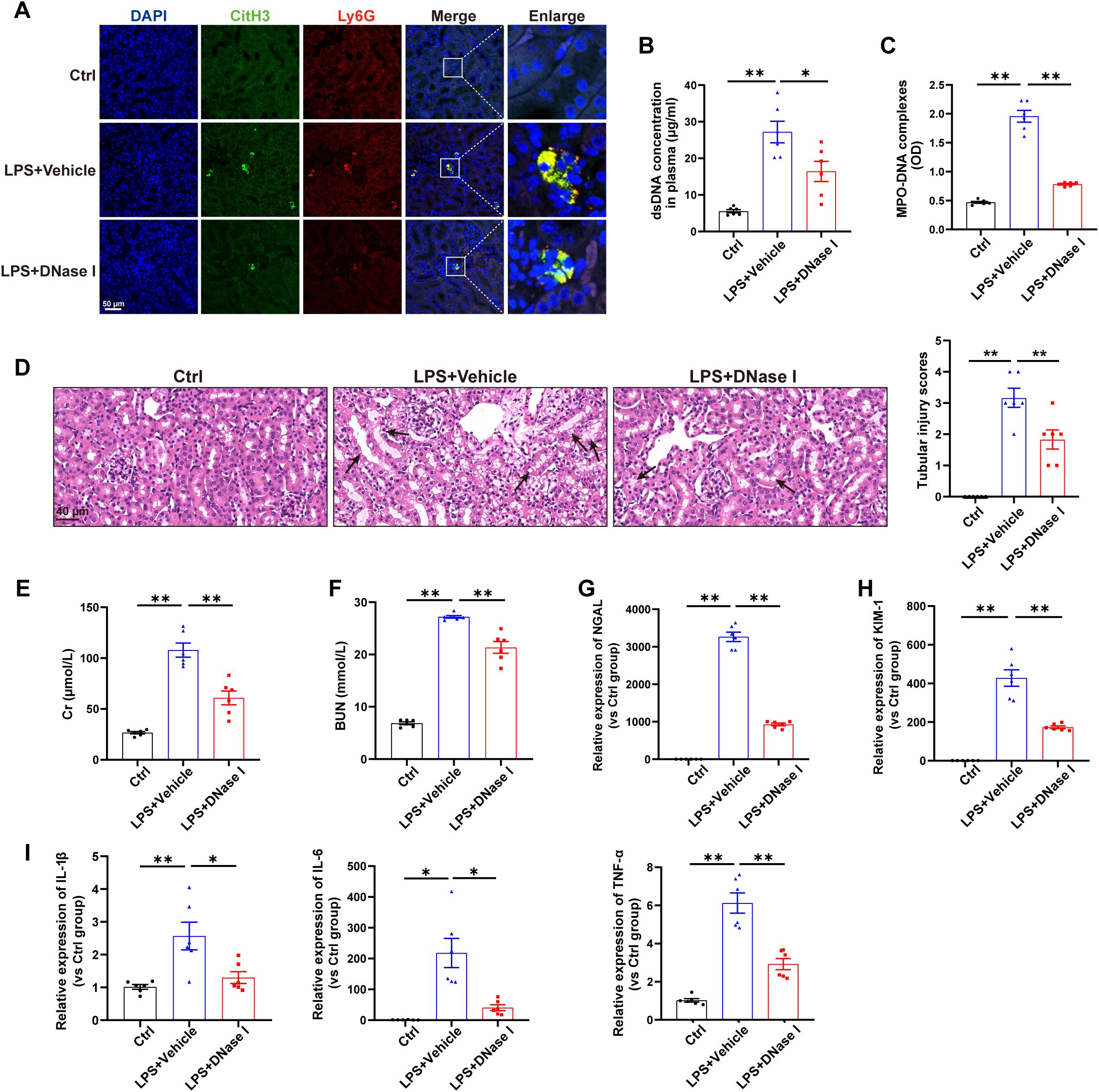 Immunofluorescence and histological analysis of three groups: Ctrl, LPS+Vehicle, and LPS+DNase I. Image A shows staining for DAPI, CitH3, and Ly6G, with merged and enlarged views. Graphs B and C display dsDNA and MPO-DNA complexes concentrations. Image D features histological sections with tubular injury scores. Graphs E to I illustrate various assays: Cr, BUN, and expression levels of NGAL, KIM1, IL-1β, IL-6, and TNF-α. Statistical significance is indicated by asterisks, showing differences among the groups. Scale bars are included for orientation.