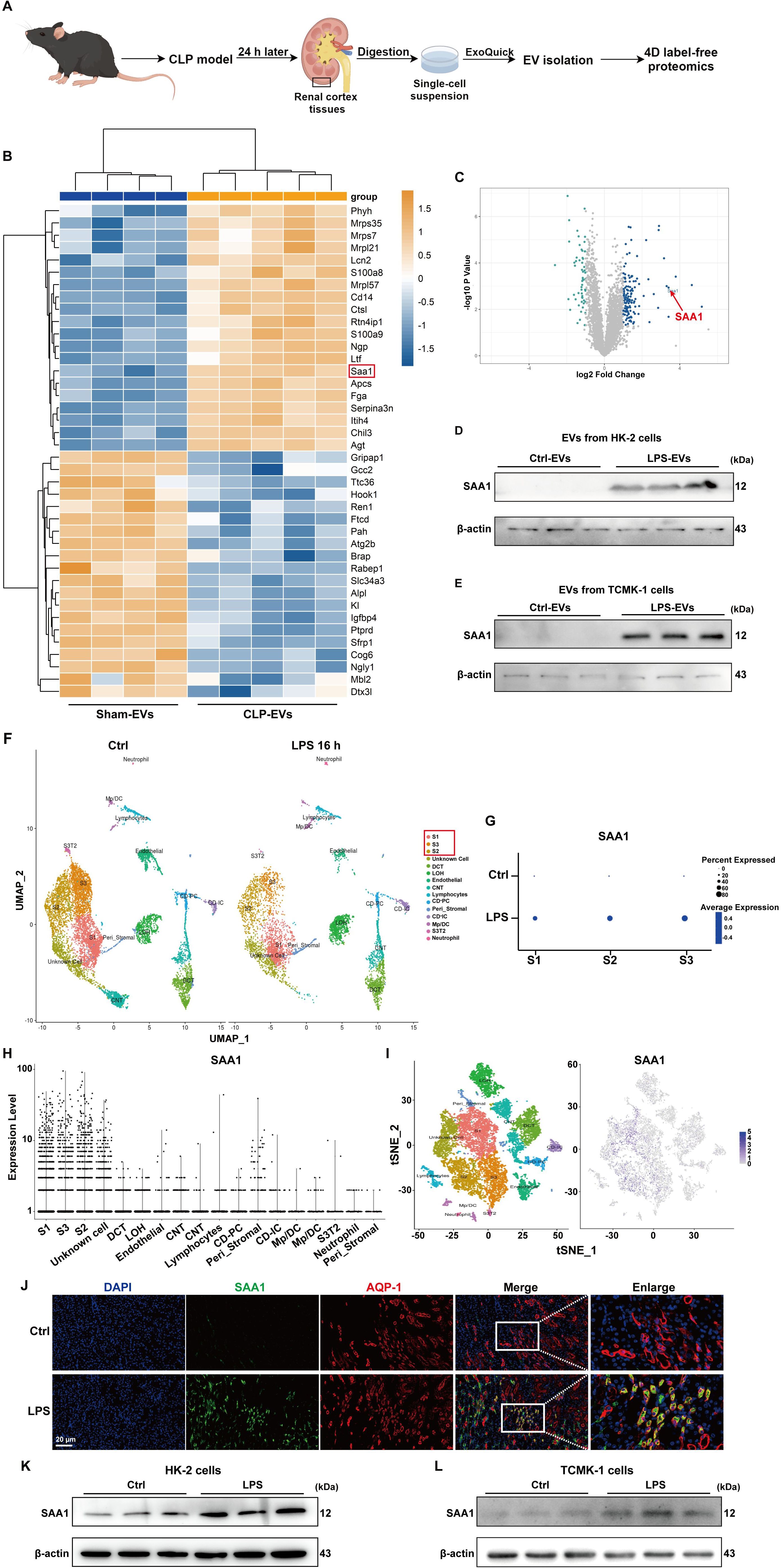 Diagram showing experimental process, heatmap, volcano plot, and protein blots related to renal cortex tissues and SAA1 expression. Includes UMAP, t-SNE plots, immunofluorescence images, and graphs illustrating expression levels in control and treated conditions.