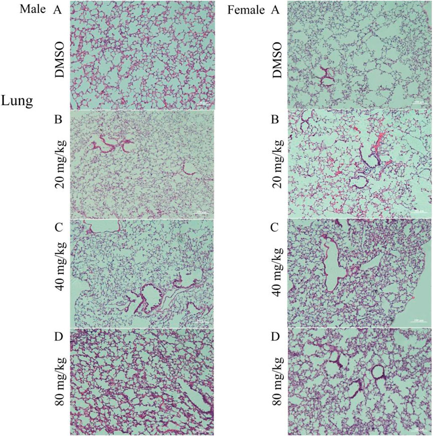 Histological images of lung tissue from male and female subjects, with four rows labeled A to D. Each row compares tissue treated with DMSO and increasing doses of a compound (20 mg/kg, 40 mg/kg, 80 mg/kg). Staining shows structural differences and damage severity corresponding to dose levels.