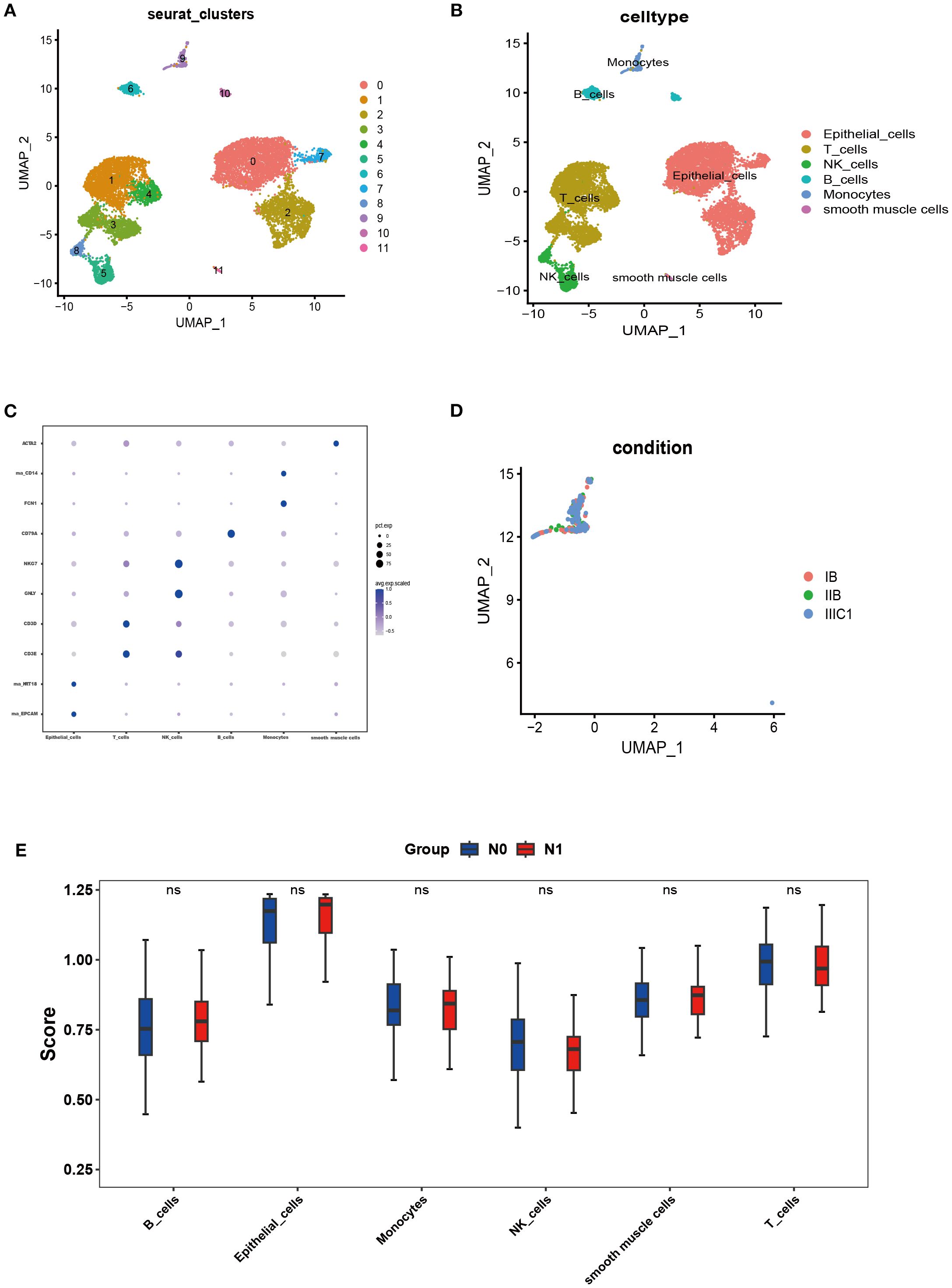 Five-panel figure displaying data visualizations. Panel A: UMAP plot showing clusters labeled as seurat clusters with 12 different colors. Panel B: UMAP plot labeled cell types with distinct clusters including epithelial cells, T cells, and others. Panel C: Bubble plot, indicating gene expression levels for different groups in blue. Panel D: UMAP plot depicting conditions labeled IB, IIB, and IIIC1. Panel E: Box plot comparing scores of cell types between groups N0 (blue) and N1 (red) with similar distribution indicated as not significant (ns).