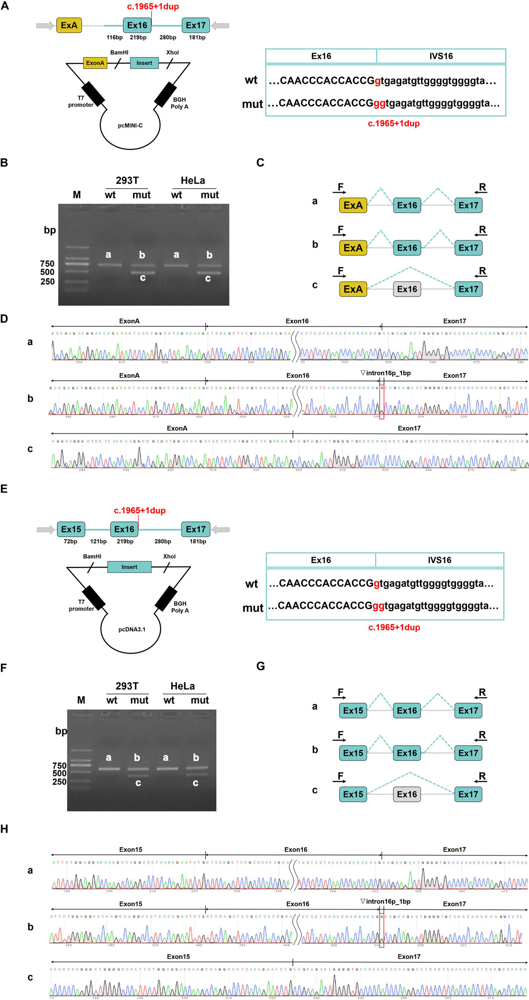Diagram detailing genetic analysis: A) Schematic of gene constructs highlighting exon insertion and duplication, with sequences showing wild type (wt) and mutant (mut) variations at c.1965+1dup. B) Gel electrophoresis results for 293T and HeLa cells, displaying band patterns labeled a, b, and c, with size markers. C) Diagrams illustrating different exon configurations with forward (F) and reverse (R) primers. D) Chromatograms show sequencing results for the exon configurations labeled a, b, and c, highlighting specific genetic variations and annotations. Genetic analysis involving exon structures and mutations. Panel E shows the exon arrangement and mutation site c.1965+1dup with wild type (wt) and mutant (mut) sequences. Panel F presents gel electrophoresis results comparing wild type and mutant DNA from 293T and HeLa cells, labeled a, b, c. Panel G illustrates different splicing configurations of Ex15, Ex16, and Ex17. Panel H displays chromatograms of exon sequences with variations labeled a, b, c, highlighting differences in nucleotide patterns.